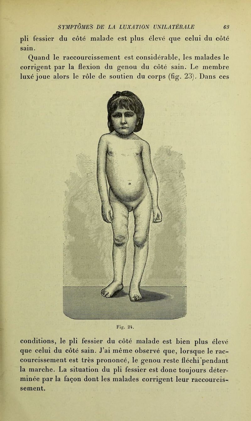 pli fessier du côté malade est plus élevé que celui du côté sain. Quand le raccourcissement est considérable, les malades le corrigent par la flexion du genou du côté sain. Le membre luxé joue alors le rôle de soutien du corps (fig. 23). Dans ces conditions, le pli fessier du côté malade est bien plus élevé que celui du côté sain. J’ai même observé que, lorsque le rac- courcissement est très prononcé, le genou reste fléchi'pendant la marche. La situation du pli fessier est donc toujours déter- minée par la façon dont les malades corrigent leur raccourcis- sement.