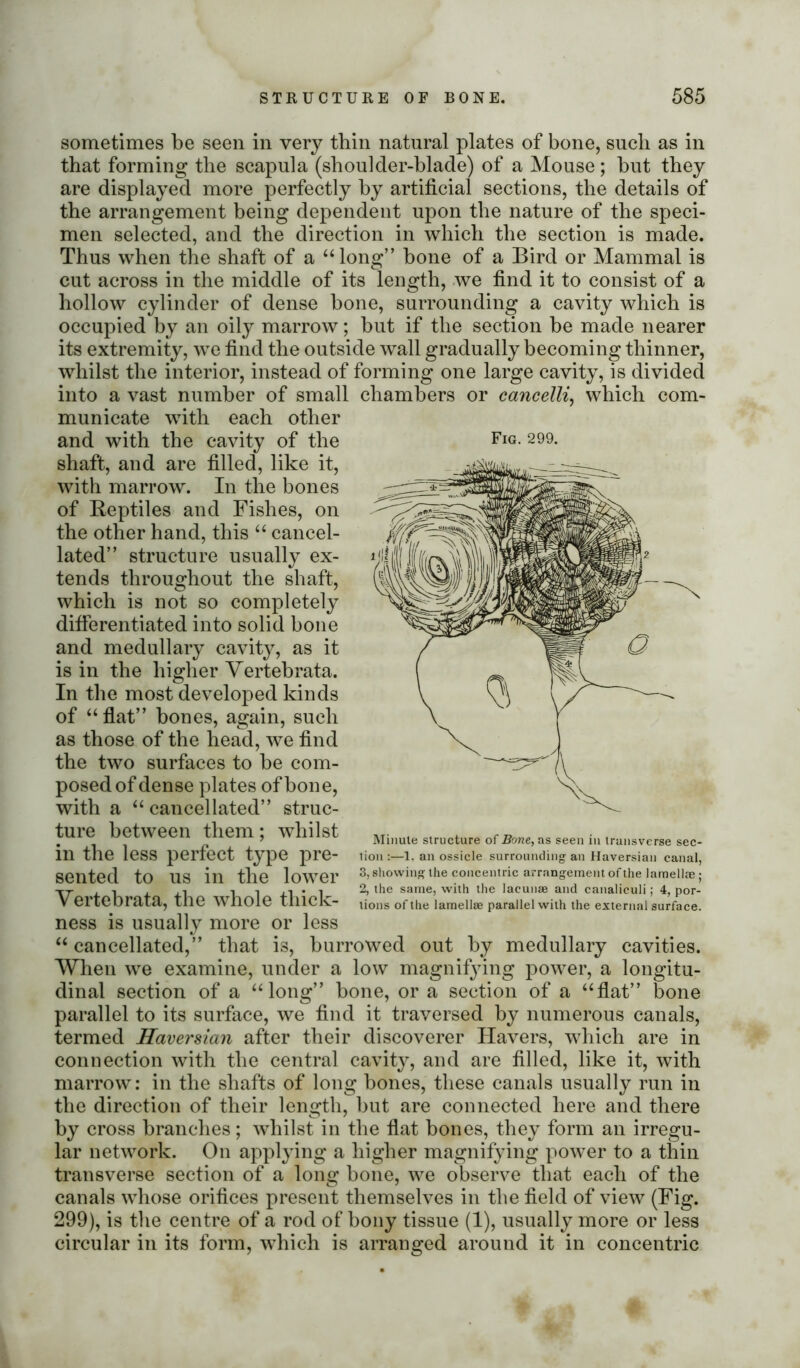 sometimes be seen in very thin natural plates of bone, such as in that forming the scapula (shoulder-blade) of a Mouse; but they are displayed more perfectly by artificial sections, the details of the arrangement being dependent upon the nature of the speci- men selected, and the direction in which the section is made. Thus when the shaft of a “long” bone of a Bird or Mammal is cut across in the middle of its length, we find it to consist of a hollow cylinder of dense bone, surrounding a cavity which is occupied by an oily marrow; but if the section be made nearer its extremity, we find the outside wall gradually becoming thinner, whilst the interior, instead of forming one large cavity, is divided into a vast number of small chambers or cancelli, which com- municate with each other and with the cavity of the Fig- 2- shaft, and are filled, like it, with marrow. In the bones of Reptiles and Fishes, on the other hand, this “ cancel- lated” structure usually ex- tends throughout the shaft, which is not so completely differentiated into solid bone and medullary cavity, as it is in the higher Vertebrata. In the most developed kinds of “flat” bones, again, such as those of the head, we find the two surfaces to be com- posed of dense plates of bone, with a “ cancellated” struc- ture between them; whilst in the less perfect type pre- sented to us in the lower Vertebrata, the whole thick- ness is usually more or less “cancellated,” that is, burrowed out by medullary cavities. When we examine, under a low magnifying power, a longitu- dinal section of a “long” bone, or a section of a “flat” bone parallel to its surface, we find it traversed by numerous canals, termed Haversian after their discoverer Havers, which are in connection with the central cavity, and are filled, like it, with marrow: in the shafts of long bones, these canals usually run in the direction of their length, but are connected here and there by cross branches; whilst in the flat bones, they form an irregu- lar network. On applying a higher magnifying power to a thin transverse section of a long bone, we observe that each of the canals whose orifices present themselves in the field of view (Fig. 299), is the centre of a rod of bony tissue (1), usually more or less circular in its form, which is arranged around it in concentric Minute structure of Bone, as seen in transverse sec- lion :—1. an ossicle surrounding an Haversian canal, 3, showing the concentric arrangement of the lamellae ; 2, the same, with the lacunae and canaliculi; 4, por- tions of the lamellae parallel with the external surface.