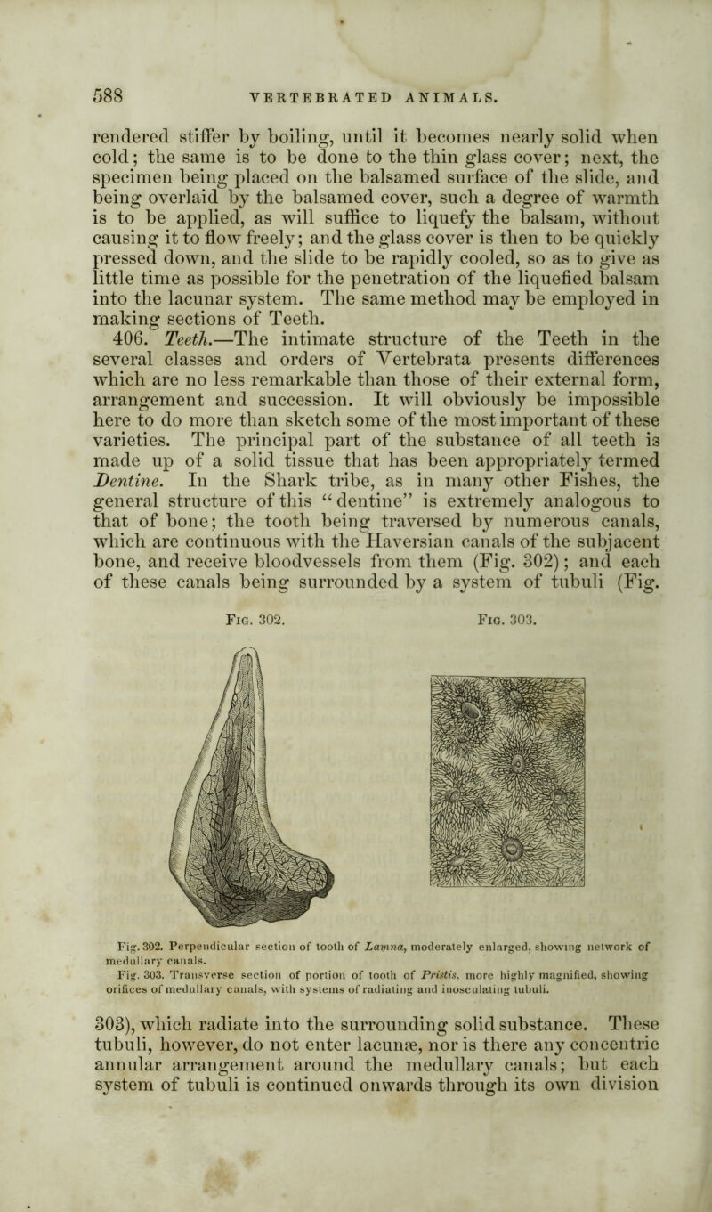 rendered stiffer by boiling, until it becomes nearly solid when cold; the same is to be done to the thin glass cover; next, the specimen being placed on the balsamed surface of the slide, and being overlaid by the balsamed cover, such a degree of warmth is to be applied, as will suffice to liquefy the balsam, without causing it to flow freely; and the glass cover is then to be quickly pressed down, and the slide to be rapidly cooled, so as to give as little time as possible for the penetration of the liquefied balsam into the lacunar system. The same method may be employed in making sections of Teeth. 406. Teeth.—The intimate structure of the Teeth in the several classes and orders of Vertebrata presents differences which are no less remarkable than those of their external form, arrangement and succession. It will obviously be impossible here to do more than sketch some of the most important of these varieties. The principal part of the substance of all teeth i3 made up of a solid tissue that has been appropriately termed Dentine. In the Shark tribe, as in many other Fishes, the general structure of this “ dentine” is extremely analogous to that of bone; the tooth being traversed by numerous canals, which are continuous with the Haversian canals of the subjacent bone, and receive bloodvessels from them (Fig. 302); and each of these canals being surrounded by a system of tubuli (Fig. Fig. 302. Fig. 303. Fig. 302. Perpendicular section of tooth of Lamna, moderately enlarged, showing network of medullary canals. Fig. 303. Transverse section of portion of tooth of Pristis. more highly magnified, showing orifices of medullary canals, with systems of radiating and inosculating tubuli. 303), which radiate into the surrounding solid substance. These tubuli, however, do not enter lacume, nor is there any concentric annular arrangement around the medullary canals; but each system of tubuli is continued onwards through its own division
