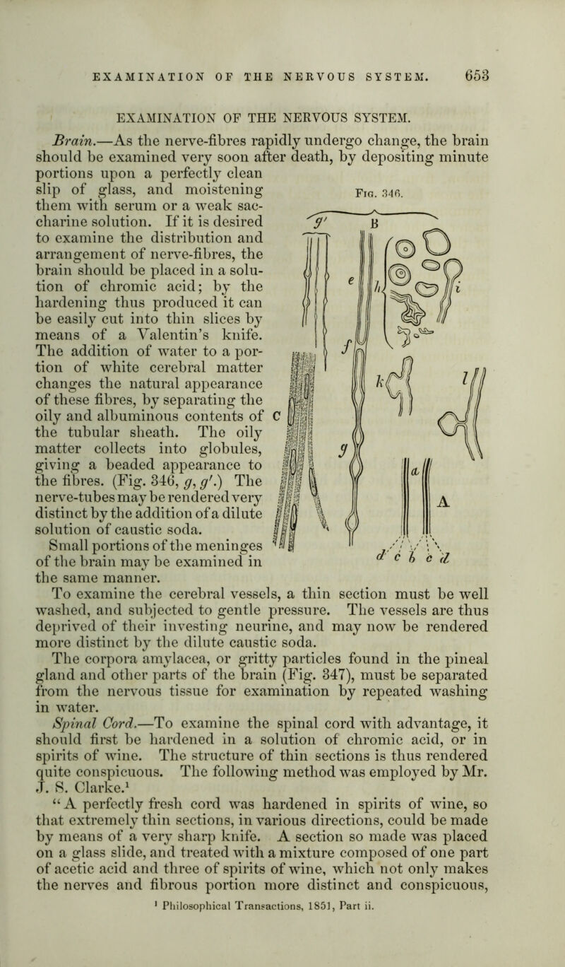 EXAMINATION OF THE NERVOUS SYSTEM. Brain.—As the nerve-fibres rapidly undergo change, the brain should be examined very soon after death, by depositing minute portions upon a perfectly clean slip of glass, and moistening them with serum or a weak sac- charine solution. If it is desired to examine the distribution and arrangement of nerve-fibres, the brain should be placed in a solu- tion of chromic acid; by the hardening thus produced it can be easily cut into thin slices by means of a Valentin’s knife. The addition of water to a por- tion of white cerebral matter changes the natural appearance of these fibres, by separating the oily and albuminous contents of the tubular sheath. The oily matter collects into globules, giving a beaded appearance to the fibres. (Fig. 346, g, g'.) The nerve-tubes may be rendered very distinct by the addition of a dilute solution of caustic soda. Small portions of the meninges of the brain may be examined in the same manner. To examine the cerebral vessels, a thin section must be well washed, and subjected to gentle pressure. The vessels are thus deprived of their investing neurine, and may now be rendered more distinct by the dilute caustic soda. The corpora amylacea, or gritty particles found in the pineal gland and other parts of the brain (Fig. 347), must be separated from the nervous tissue for examination by repeated washing in water. Spinal Cord.—To examine the spinal cord with advantage, it should first be hardened in a solution of chromic acid, or in spirits of wine. The structure of thin sections is thus rendered quite conspicuous. The following method was employed by Mr. J. S. Clarke.1 “ A perfectly fresh cord was hardened in spirits of wine, so that extremely thin sections, in various directions, could be made by means of a very sharp knife. A section so made was placed on a glass slide, and treated with a mixture composed of one part of acetic acid and three of spirits of wine, which not only makes the nerves and fibrous portion more distinct and conspicuous, 1 Philosophical Transactions, 1851, Part ii. Fig. 346.