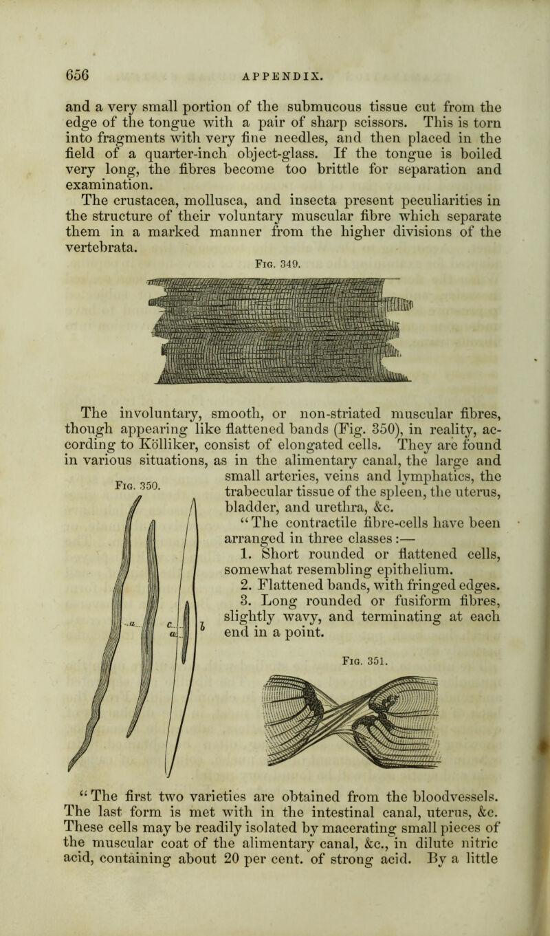 and a very small portion of the submucous tissue cut from the edge of the tongue with a pair of sharp scissors. This is torn into fragments with very fine needles, and then placed in the field of a quarter-inch object-glass. If the tongue is boiled very long, the fibres become too brittle for separation and examination. The Crustacea, mollusca, and insecta present peculiarities in the structure of their voluntary muscular fibre which separate them in a marked manner from the higher divisions of the vertebrata. Fig. 349. Fig. 350. The involuntary, smooth, or non-striated muscular fibres, though appearing like flattened hands (Fig. 350), in reality, ac- cording to Kolliker, consist of elongated cells. They are found in various situations, as in the alimentary canal, the large and small arteries, veins and lymphatics, the trabecular tissue of the spleen, the uterus, bladder, and urethra, &c. “The contractile fibre-cells have been arranged in three classes :— 1. Short rounded or flattened cells, somewhat resembling epithelium. 2. Flattened bands, with fringed edges. 3. Long rounded or fusiform fibres, slightly wavy, and terminating at each end in a point. Fig. 351. “ The first two varieties are obtained from the bloodvessels. The last form is met with in the intestinal canal, uterus, &c. These cells may be readily isolated by macerating small pieces of the muscular coat of the alimentary canal, &c., in dilute nitric acid, containing about 20 per cent, of strong acid. By a little