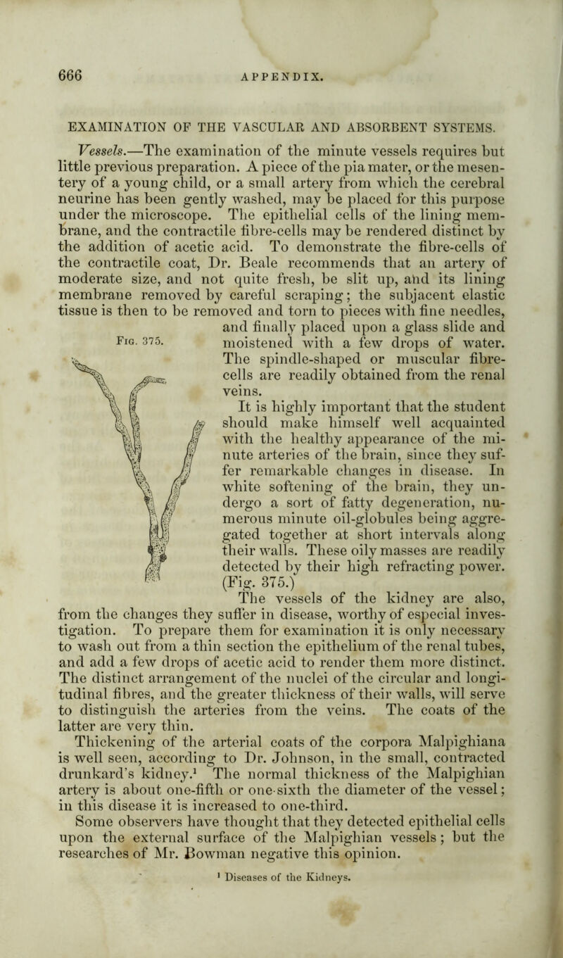 Fig. 375. EXAMINATION OF THE VASCULAR AND ABSORBENT SYSTEMS. Vessels.—The examination of the minute vessels requires but little previous preparation. A piece of the pia mater, or the mesen- tery of a young child, or a small artery from which the cerebral neurine has been gently washed, may be placed for this purpose under the microscope. The epithelial cells of the lining mem- brane, and the contractile tibre-cells may be rendered distinct by the addition of acetic acid. To demonstrate the fibre-cells of the contractile coat, Dr. Beale recommends that an artery of moderate size, and not quite fresh, be slit up, and its lining membrane removed by careful scraping; the subjacent elastic tissue is then to be removed and torn to pieces with fine needles, and finally placed upon a glass slide and moistened with a few drops of water. The spindle-shaped or muscular fibre- cells are readily obtained from the renal veins. It is highly important that the student should make himself well acquainted with the healthy appearance of the mi- nute arteries of the brain, since they suf- fer remarkable changes in disease. In white softening of the brain, they un- dergo a sort of fatty degeneration, nu- merous minute oil-globules being aggre- gated together at short intervals along their walls. These oily masses are readily detected by their high refracting power. (Fig. 875.) The vessels of the kidney are also, from the changes they suffer in disease, worthy of especial inves- tigation. To prepare them for examination it is only necessary to wash out from a thin section the epithelium of the renal tubes, and add a few drops of acetic acid to render them more distinct. The distinct arrangement of the nuclei of the circular and longi- tudinal fibres, and the greater thickness of their walls, will serve to distinguish the arteries from the veins. The coats of the latter are very thin. Thickening of the arterial coats of the corpora Malpighiana is well seen, according to Dr. Johnson, in the small, contracted drunkard’s kidney.1 The normal thickness of the Malpighian artery is about one-fifth or one-sixth the diameter of the vessel; in this disease it is increased to one-third. Some observers have thought that they detected epithelial cells upon the external surface of the Malpighian vessels; but the researches of Mr. Bowman negative this opinion. 1 Diseases of the Kidneys.