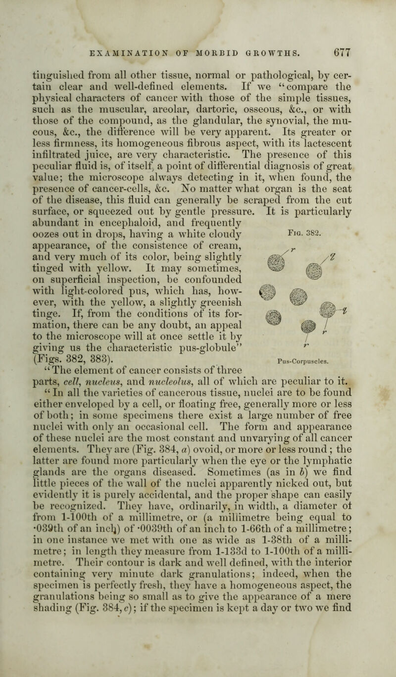 tinguislied from all other tissue, normal or pathological, by cer- tain clear and well-defined elements. If we “compare the physical characters of cancer with those of the simple tissues, such as the muscular, areolar, dartoric, osseous, &c., or with those of the compound, as the glandular, the synovial, the mu- cous, &c., the difference will be very apparent. Its greater or less firmness, its homogeneous fibrous aspect, with its lactescent infiltrated juice, are very characteristic. The presence of this peculiar fluid is, of itself a point of differential diagnosis of great value; the microscope always detecting in it, when found, the presence of cancer-cells, &c. Ho matter what organ is the seat of the disease, this fluid can generally be scraped from the cut surface, or squeezed out by gentle pressure. It is particularly abundant in encephaloid, and frequently oozes out in drops, having a white cloudy appearance, of the consistence of cream, and very much of its color, being slightly tinged with yellow. It may sometimes, on superficial inspection, be confounded with light-colored pus, which has, how- ever, with the yellow, a slightly greenish tinge. If, from the conditions of its for- mation, there can be any doubt, an appeal to the microscope will at once settle it by giving us the characteristic pus-globule” (Figs. 882, 383). “The element of cancer consists of three parts, cell, nucleus, and nucleolus, all of which are peculiar to it. “ In all the varieties of cancerous tissue, nuclei are to be found either enveloped by a cell, or floating free, generally more or less of both; in some specimens there exist a large number of free nuclei with only an occasional cell. The form and appearance of these nuclei are the most constant and unvarying of all cancer elements. They are (Fig. 384, a) ovoid, or more or less round ; the latter are found more particularly when the eye or the lymphatic glands are the organs diseased. Sometimes (as in b) we find little pieces of the wall of the nuclei apparently nicked out, but evidently it is purely accidental, and the proper shape can easily be recognized. They have, ordinarily, in width, a diameter ot from 1-100th of a millimetre, or (a millimetre being equal to •039th of an incl}) of *0039th of an inch to l-66th of a millimetre; in one instance we met with one as wide as l-38th of a milli- metre ; in length they measure from l-133d to l-100th of a milli- metre. Their contour is dark and well defined, with the interior containing very minute dark granulations; indeed, when the specimen is perfectly fresh, they have a homogeneous aspect, the granulations being so small as to give the appearance of a mere shading (Fig. 384, c); if the specimen is kept a day or two we find Fig. 382. T Pus-Corpuscles.