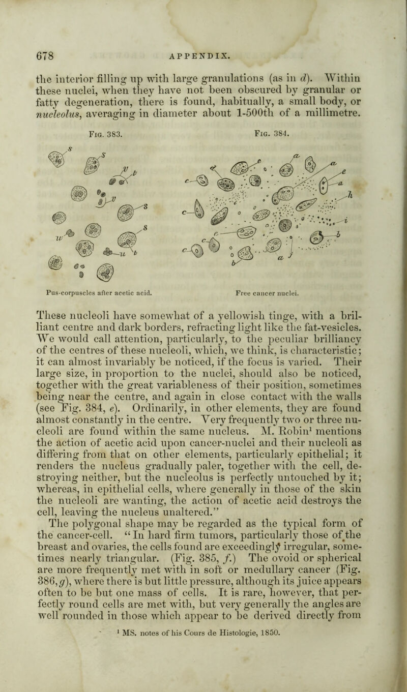 the interior filling up with large granulations (as in d). Within these nuclei, when they have not been obscured by granular or fatty degeneration, there is found, habitually, a small body, or nucleolus, averaging in diameter about l-500th of a millimetre. Fig. 383. Fig. 384. Pus-corpuscles after acetic acid. These nucleoli have somewhat of a yellowish tinge, with a bril- liant centre and dark borders, refracting light like the fat-vesicles. We would call attention, particularly, to the peculiar brilliancy of the centres of these nucleoli, which, we think, is characteristic; it can almost invariably be noticed, if the focus is varied. Their large size, in proportion to the nuclei, should also he noticed, together with the great variableness of their position, sometimes being near the centre, and again in close contact with the walls (see Fig. 384, e). Ordinarily, in other elements, they are found almost constantly in the centre. Very frequently two or three nu- cleoli are found within the same nucleus. M. Robin1 mentions the action of acetic acid upon cancer-nuclei and their nucleoli as differing from that on other elements, particularly epithelial; it renders the nucleus gradually paler, together with the cell, de- stroying neither, but the nucleolus is perfectly untouched by it; whereas, in epithelial cells, where generally in those of the skin the nucleoli are wanting, the action of acetic acid destroys the cell, leaving the nucleus unaltered.” The polygonal shape may be regarded as the typical form of the cancer-cell. “In hard firm tumors, particularly those of the breast and ovaries, the cells found are exceedingly irregular, some- times nearly triangular. (Fig. 385, /.) The ovoid or spherical are more frequently met with in soft or medullary cancer (Fig. 386, ^r), where there is but little pressure, although its juice appears often to be but one mass of cells. It is rare, however, that per- fectly round cells are met with, but very generally the angles are well rounded in those which appear to be derived directly from 1 MS. notes of his Cours de Histologie, 1850.