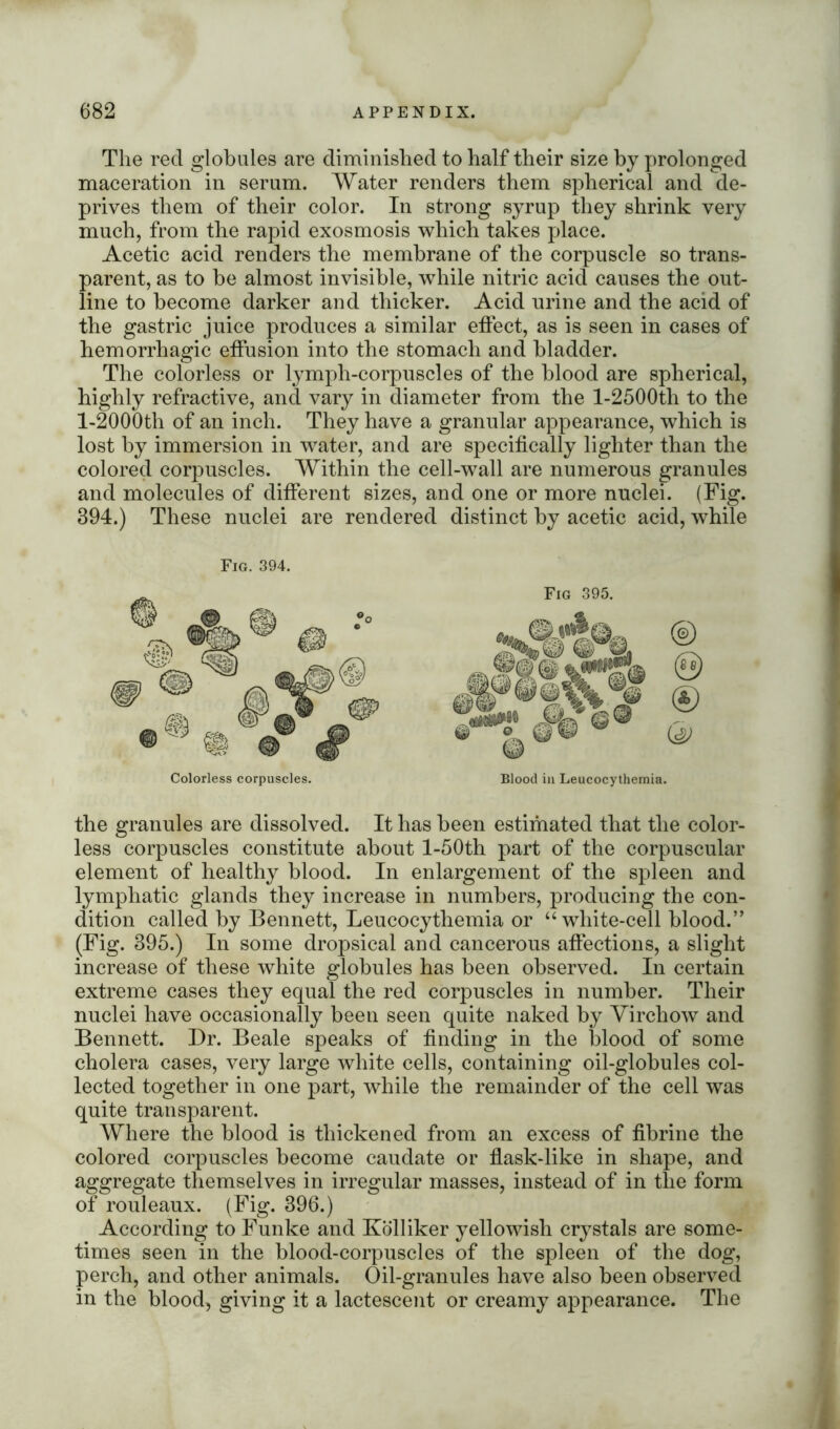 The reel globules are diminished to half their size by prolonged maceration in serum. Water renders them spherical and de- prives them of their color. In strong syrup they shrink very much, from the rapid exosmosis which takes place. Acetic acid renders the membrane of the corpuscle so trans- parent, as to be almost invisible, while nitric acid causes the out- line to become darker and thicker. Acid urine and the acid of the gastric juice produces a similar effect, as is seen in cases of hemorrhagic effusion into the stomach and bladder. The colorless or lymph-corpuscles of the blood are spherical, highly refractive, and vary in diameter from the l-2500th to the l-2000th of an inch. They have a granular appearance, which is lost by immersion in water, and are specifically lighter than the colored corpuscles. Within the cell-wall are numerous granules and molecules of different sizes, and one or more nuclei. (Fig. 394.) These nuclei are rendered distinct by acetic acid, while Fig. 394. Fig 395. Blood in Leucocythemia. the granules are dissolved. It has been estimated that the color- less corpuscles constitute about l-50th part of the corpuscular element of healthy blood. In enlargement of the spleen and lymphatic glands they increase in numbers, producing the con- dition called by Bennett, Leucocythemia or “white-cell blood.” (Fig. 395.) In some dropsical and cancerous affections, a slight increase of these white globules has been observed. In certain extreme cases they equal the red corpuscles in number. Their nuclei have occasionally been seen quite naked by Virchow and Bennett. Dr. Beale speaks of finding in the blood of some cholera cases, very large white cells, containing oil-globules col- lected together in one part, while the remainder of the cell was quite transparent. Where the blood is thickened from an excess of fibrine the colored corpuscles become caudate or flask-like in shape, and aggregate themselves in irregular masses, instead of in the form of rouleaux. (Fig. 396.) According to Funke and Kolliker yellowish crystals are some- times seen in the blood-corpuscles of the spleen of the dog, perch, and other animals. Oil-granules have also been observed in the blood, giving it a lactescent or creamy appearance. The
