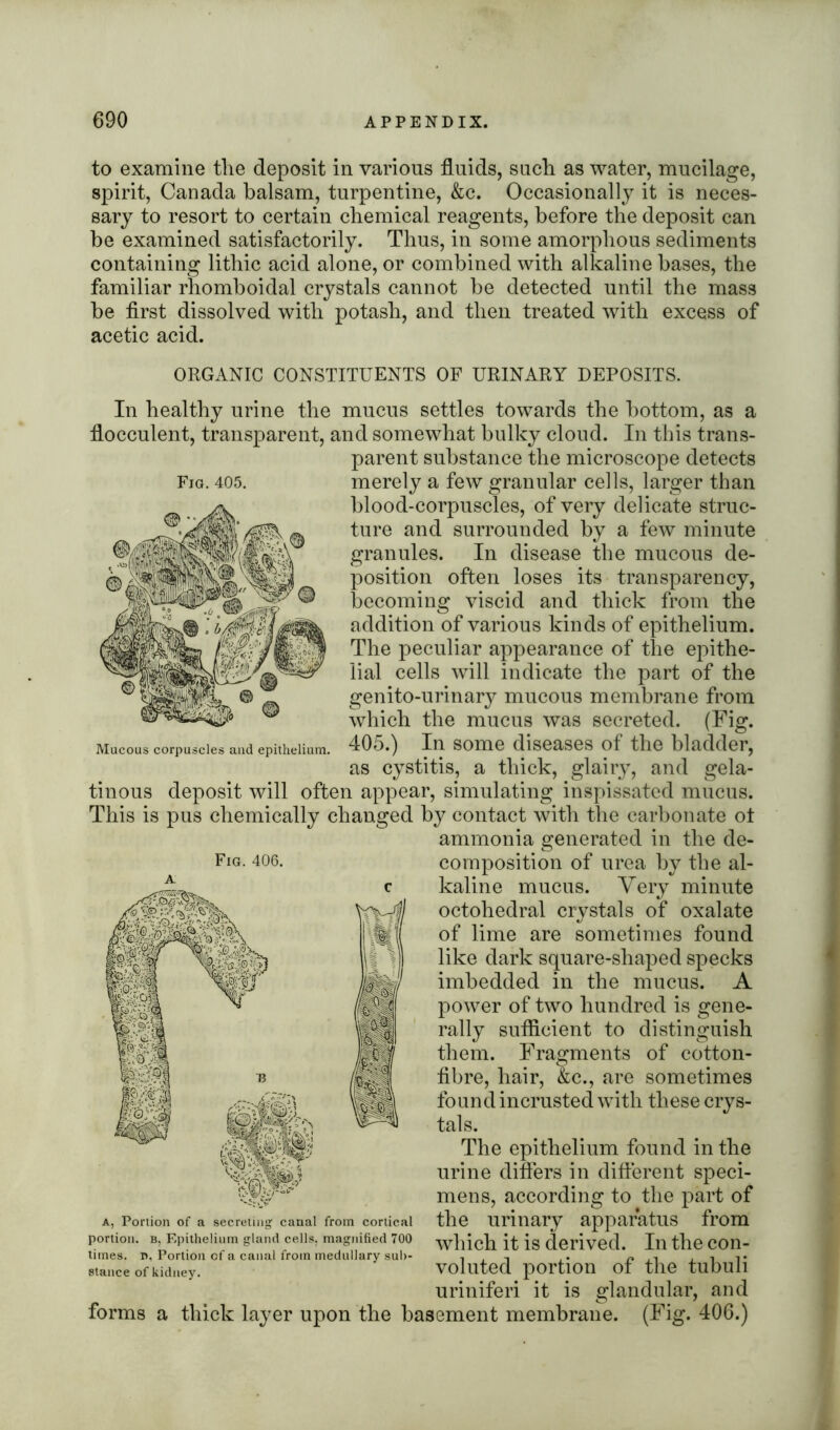 to examine the deposit in various fluids, such as water, mucilage, spirit, Canada balsam, turpentine, &c. Occasionally it is neces- sary to resort to certain chemical reagents, before the deposit can be examined satisfactorily. Thus, in some amorphous sediments containing lithic acid alone, or combined with alkaline bases, the familiar rhomboidal crystals cannot be detected until the mass be first dissolved with potash, and then treated with excess of acetic acid. Mucous corpuscles and epithelium. ORGANIC CONSTITUENTS OF URINARY DEPOSITS. In healthy urine the mucus settles towards the bottom, as a flocculent, transparent, and somewhat bulky cloud. In this trans- parent substance the microscope detects Fig. 405. merely a few granular cells, larger than blood-corpuscles, of very delicate struc- ture and surrounded by a few minute granules. In disease the mucous de- position often loses its transparency, becoming viscid and thick from the addition of various kinds of epithelium. The peculiar appearance of the epithe- lial cells will indicate the part of the genito-urinary mucous membrane from which the mucus was secreted. (Fig. 405.) In some diseases of the bladder, as cystitis, a thick, glairy, and gela- tinous deposit will often appear, simulating inspissated mucus. This is pus chemically changed by contact with the carbonate ot ammonia generated in the de- Fig. 406. composition of urea by the al- kaline mucus. Very minute octohedral crystals of oxalate of lime are sometimes found like dark square-shaped specks imbedded in the mucus. A power of two hundred is gene- rally sufficient to distinguish them. Fragments of cotton- fibre, hair, &c., are sometimes found incrusted with these crys- tals. The epithelium found in the urine differs in different speci- mens, according to the part of the urinary apparatus from which it is derived. In the con- voluted portion of the tubuli uriniferi it is glandular, and forms a thick layer upon the basement membrane. (Fig. 406.) a, Portion of a secreting canal from cortical portion, b, Epithelium gland cells, magnified 700 limes, n, Portion of a canal from medullary sub- stance of kidney.