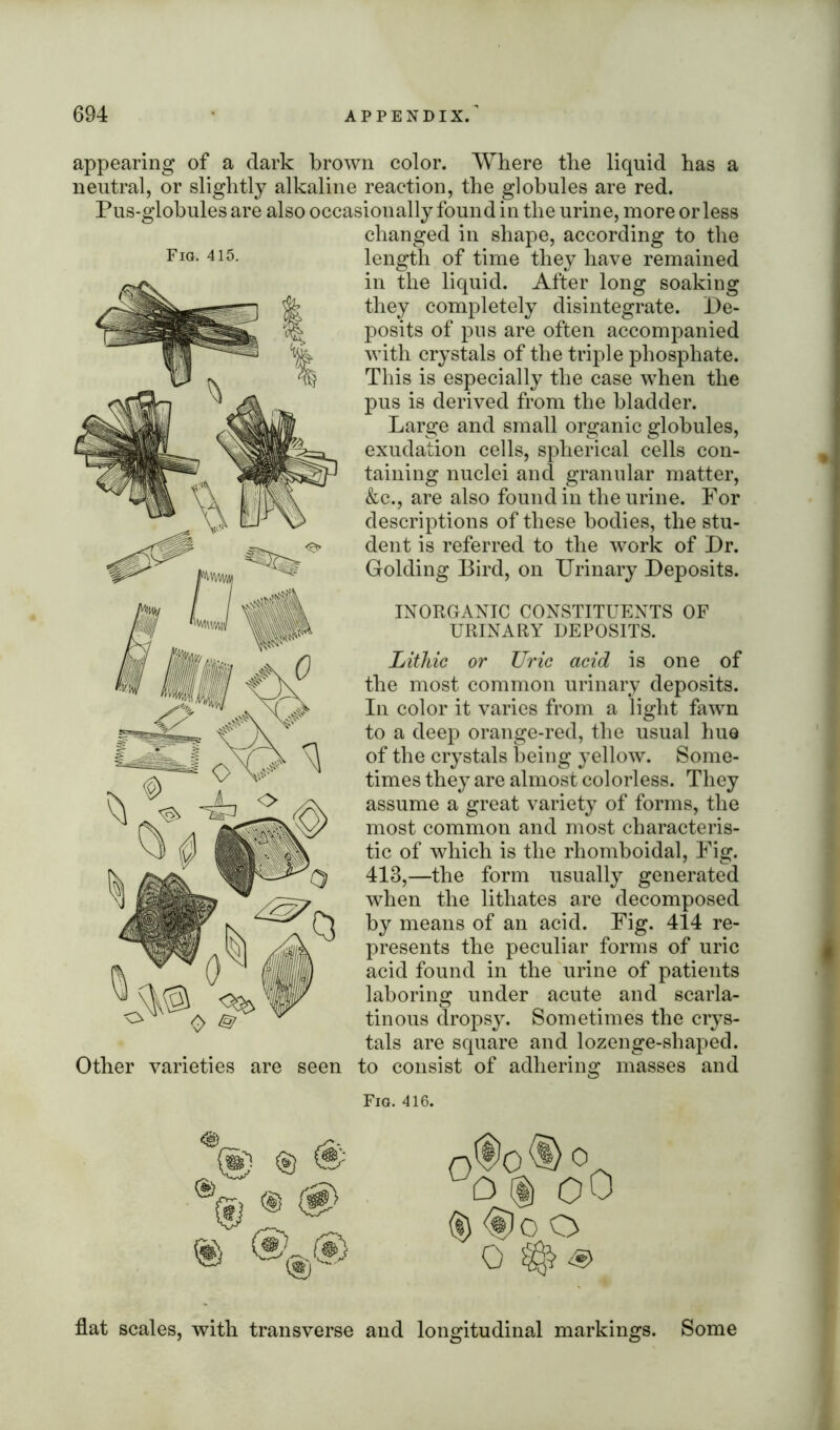 Fig. 415. appearing of a dark brown color. Where the liquid has a neutral, or slightly alkaline reaction, the globules are red. Pus-globules are also occasionally found in the urine, more or less changed in shape, according to the length of time they have remained in the liquid. After long soaking they completely disintegrate. De- posits of pus are often accompanied with crystals of the triple phosphate. This is especially the case when the pus is derived from the bladder. Large and small organic globules, exudation cells, spherical cells con- taining nuclei and granular matter, &c., are also found in the urine. For descriptions of these bodies, the stu- dent is referred to the work of Dr. Golding Bird, on Urinary Deposits. INORGANIC CONSTITUENTS URINARY DEPOSITS. OF Other varieties are seen Lithic or Uric acid is one of the most common urinary deposits. In color it varies from a light fawn to a deep orange-red, the usual hue of the crystals being yellow. Some- times they are almost colorless. They assume a great variety of forms, the most common and most characteris- tic of which is the rhomboidal, Fig. 413,—the form usually generated when the lithates are decomposed by means of an acid. Fig. 414 re- presents the peculiar forms of uric acid found in the urine of patients laboring under acute and scarla- tinous dropsy. Sometimes the crys- tals are square and lozenge-shaped, to consist of adhering masses and Fig. 416. flat scales, with transverse and longitudinal markings. Some