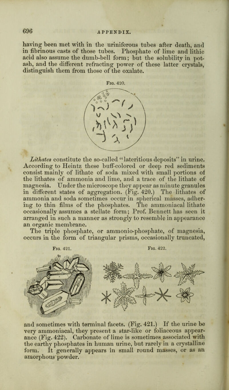 having been met with in the uriniferous tubes after death, and in fibrinous casts of those tubes. Phosphate of lime and lithic acid also assume the dumb-bell form; but the solubility in pot- ash, and the different refracting power of these latter crystals, distinguish them from those of the oxalate. Fig. 420. Lithates constitute the so-called “lateritious deposits” in urine. According to Heintz these huff-colored or deep red sediments consist mainly of lithate of soda mixed with small portions of the lithates of ammonia and lime, and a trace of the lithate of magnesia. Under the microscope they appear as minute granules in different states of aggregation. (Fig. 420.) The lithates of ammonia and soda sometimes occur in spherical masses, adher- ing to thin films of the phosphates. The ammoniacal lithate occasionally assumes a stellate form; Prof. Bennett has seen it arranged in such a manner as strongly to resemble in appearance an organic membrane. The triple phosphate, or ammonio-phosphate, of magnesia, occurs in the form of triangular prisms, occasionally truncated, Fig. 421. Fig. 422. and sometimes with terminal facets. (Fig. 421.) If the urine he very ammoniacal, they present a star-like or foliaceous appear- ance (Fig. 422). Carbonate of lime is sometimes associated with the earthy phosphates in human urine, hut rarely in a crystalline form. It generally appears in small round masses, or as an amorphous powder.