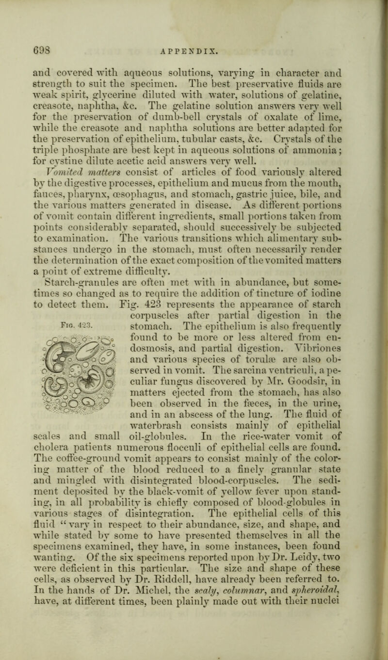 and covered with aqueous solutions, varying in character and strength to suit the specimen. The best preservative fluids are weak spirit, glycerine diluted with water, solutions of gelatine, creasote, naphtha, &c. The gelatine solution answers very well for the preservation of dumb-bell crystals of oxalate of lime, while the creasote and naphtha solutions are better adapted for the preservation of epithelium, tubular casts, &c. Crystals of the triple phosphate are best kept in aqueous solutions of ammonia; for cystine dilute acetic acid answers very well. Vomited matters consist of articles of food variously altered by the digestive processes, epithelium and mucus from the mouth, fauces, pharynx, oesophagus, and stomach, gastric juice, bile, and the various matters generated in disease. As different portions of vomit contain different ingredients, small portions taken from points considerably separated, should successively be subjected to examination. The various transitions which alimentary sub- stances undergo in the stomach, must often necessarily render the determination of the exact composition of the vomited matters a point of extreme difficulty. Starch-granules are often met with in abundance, but some- times so changed as to require the addition of tincture of iodine to detect them. Fig. 423 represents the appearance of starch corpuscles after partial digestion in the stomach. The epithelium is also frequently found to be more or less altered from en- dosmosis, and partial digestion. Vibriones and various species of toruke are also ob- served in vomit. The sarcina ventriculi, a pe- culiar fungus discovered by Mr. Goodsir, in matters ejected from the stomach, has also been observed in the fleces, in the urine, and in an abscess of the lung. The fluid of waterbrash consists mainly of epithelial scales and small oil-globules. In the rice-water vomit of cholera patients numerous flocculi of epithelial cells are found. The coffee-ground vomit appears to consist mainly of the color- ing matter of the blood reduced to a finely granular state and mingled with disintegrated blood-corpuscles. The sedi- ment deposited by the black-vomit of yellow fever upon stand- ing, in all probability is chiefly composed of blood-globules in various stages of disintegration. The epithelial cells of this fluid “ vary in respect to their abundance, size, and shape, and while stated by some to have presented themselves in all the specimens examined, they have, in some instances, been found wanting. Of the six specimens reported upon by Dr. Leidy, two were deficient in this particular. The size and shape of these cells, as observed by Dr. Riddell, have already been referred to. In the hands of Dr. Michel, the scaly, columnar, and spheroidal, have, at different times, been plainly made out with their nuclei