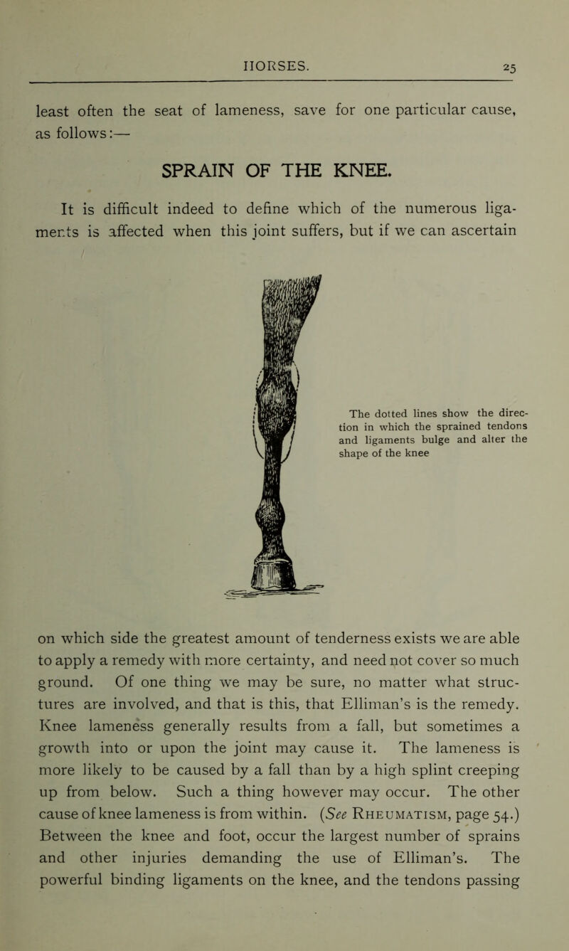 least often the seat of lameness, save for one particular cause, as follows:— SPRAIN OF THE KNEE* It is difficult indeed to define which of the numerous liga- ments is affected when this joint suffers, but if we can ascertain The dotted lines show the direc- tion in which the sprained tendons and ligaments bulge and alter the shape of the knee on which side the greatest amount of tenderness exists we are able to apply a remedy with more certainty, and need pot cover so much ground. Of one thing we may be sure, no matter what struc- tures are involved, and that is this, that Elliman’s is the remedy. Knee lameness generally results from a fall, but sometimes a growth into or upon the joint may cause it. The lameness is more likely to be caused by a fall than by a high splint creeping up from below. Such a thing however may occur. The other cause of knee lameness is from within. (See Rheumatism, page 54.) Between the knee and foot, occur the largest number of sprains and other injuries demanding the use of Elliman’s. The powerful binding ligaments on the knee, and the tendons passing