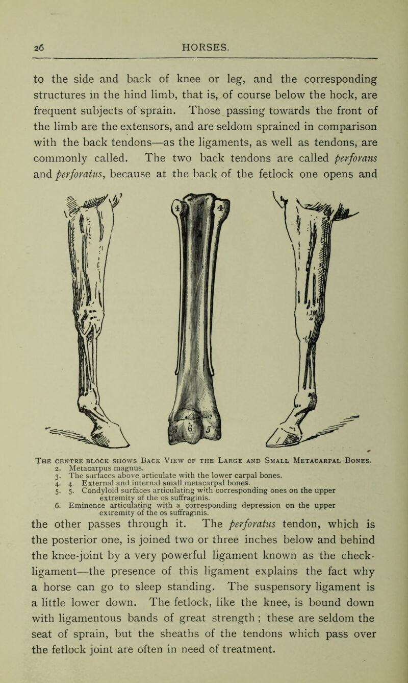 to the side and back of knee or leg, and the corresponding structures in the hind limb, that is, of course below the hock, are frequent subjects of sprain. Those passing towards the front of the limb are the extensors, and are seldom sprained in comparison with the back tendons—as the ligaments, as well as tendons, are commonly called. The two back tendons are called pevfovans and perfovatus, because at the back of the fetlock one opens and The centre block shows Back View of the Large and Small Metacarpal Bones. 2. Metacarpus magnus. 3. The surfaces above articulate with the lower carpal bones. 4. 4 External and internal small metacarpal bones. 5. 5. Condyloid surfaces articulating with corresponding ones on the upper extremity of the os suffraginis. 6. Eminence articulating with a corresponding depression on the upper extremity of the os suffraginis. the other passes through it. The perfovatus tendon, which is the posterior one, is joined two or three inches below and behind the knee-joint by a very powerful ligament known as the check- ligament—the presence of this ligament explains the fact why a horse can go to sleep standing. The suspensory ligament is a little lower down. The fetlock, like the knee, is bound down with ligamentous bands of great strength ; these are seldom the seat of sprain, but the sheaths of the tendons which pass over the fetlock joint are often in need of treatment.