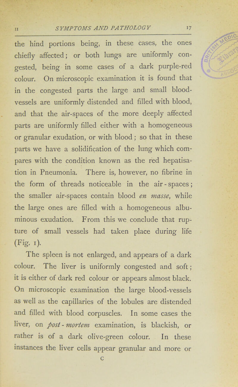 the hind portions being, in these cases, the ones chiefly affected; or both lungs are uniformly con- gested, being in some cases of a dark purple-red colour. On microscopic examination it is found that in the congested parts the large and small blood- vessels are uniformly distended and filled with blood, and that the air-spaces of the more deeply affected parts are uniformly filled either with a homogeneous or granular exudation, or with blood ; so that in these parts we have a solidification of the lung which com- pares with the condition known as the red hepatisa- tion in Pneumonia. There is, however, no fibrine in the form of threads noticeable in the air - spaces; the smaller air-spaces contain blood en masse, while the large ones are filled with a homogeneous albu- minous exudation. From this we conclude that rup- ture of small vessels had taken place during life (Fig- O- The spleen is not enlarged, and appears of a dark colour. The liver is uniformly congested and soft ; it is either of dark red colour or appears almost black. On microscopic examination the large blood-vessels as well as the capillaries of the lobules are distended and filled with blood corpuscles. In some cases the liver, on post - mortem examination, is blackish, or rather is of a dark olive-green colour. In these instances the liver cells appear granular and more or c