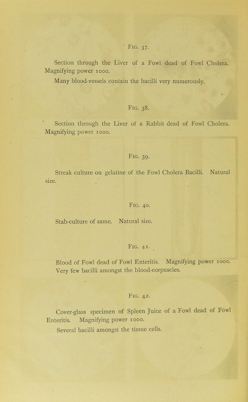 Section through the Liver of a Fowl dead of Fowl Cholera. Magnifying power xooo. Many blood-vessels contain the bacilli very numerously. Fig. 38. Section through the Liver of a Rabbit dead of Fowl Cholera. Magnifying power 1000. Fig. 39. Streak culture on gelatine of the Fowl Cholera Bacilli. Natural size. Fig. 40. Stab-culture of same. Natural size. Fig. 41. Blood of Fowl dead of Fowl Enteritis. Magnifying power 1000. Very few bacilli amongst the blood-corpuscles. Fig. 42. Cover-glass specimen of Spleen Juice of a Fowl dead of Fowl Enteritis. Magnifying power 1000. Several bacilli amongst the tissue cells.