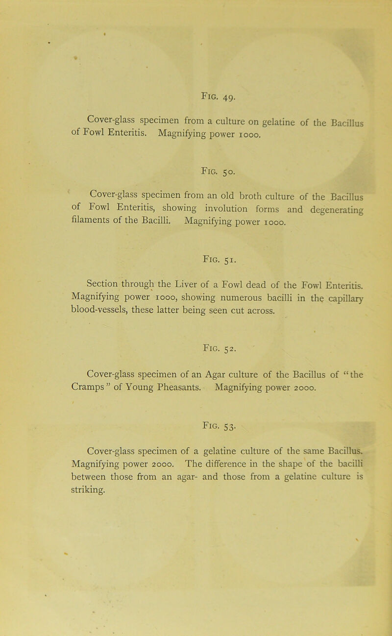 Cover-glass specimen from a culture on gelatine of the Bacillus of Fowl Enteritis. Magnifying power 1000. Fig. 50. Cover-glass specimen from an old broth culture of the Bacillus of Fowl Enteritis, showing involution forms and degenerating filaments of the Bacilli. Magnifying power 1000. Fig. 51. Section through the Liver of a Fowl dead of the Fowl Enteritis. Magnifying power 1000, showing numerous bacilli in the capillar}' blood-vessels, these latter being seen cut across. Fig. 52. Cover-glass specimen of an Agar culture of the Bacillus of “ the Cramps ” of Young Pheasants. Magnifying power 2000. Fig. 53. Cover-glass specimen of a gelatine culture of the same Bacillus. Magnifying power 2000. The difference in the shape of the bacilli between those from an agar- and those from a gelatine culture is striking.