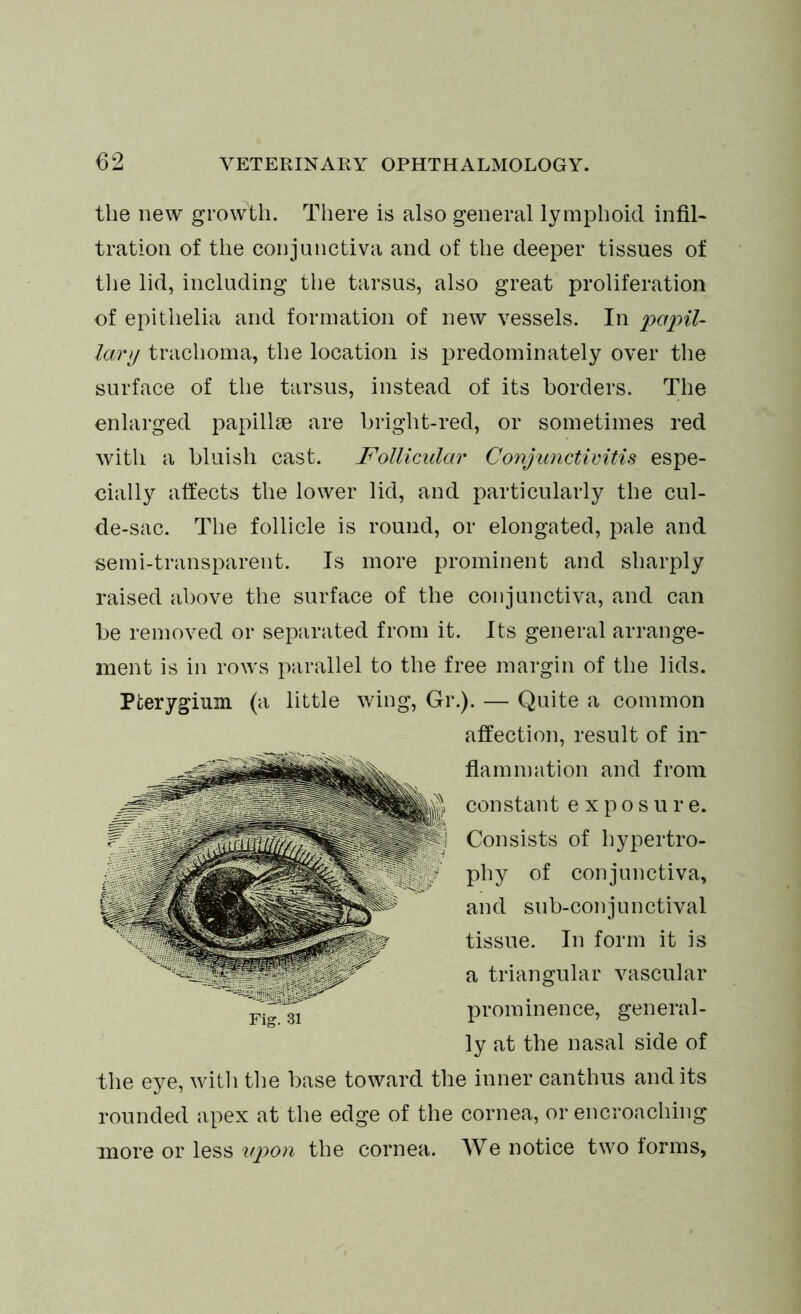 the new growth. There is also general lymphoid infil- tration of the conjunctiva and of the deeper tissues of the lid, including the tarsus, also great proliferation of epithelia and formation of new vessels. In 'papil- lary trachoma, the location is predominately over the surface of the tarsus, instead of its borders. The enlarged papillae are bright-red, or sometimes red with a bluish cast. Follicular Conjunctivitis espe- cially affects the lower lid, and particularly the cul- de-sac. The follicle is round, or elongated, pale and semi-transparent. Is more prominent and sharply raised above the surface of the conjunctiva, and can be removed or separated from it. Its general arrange- ment is in rows parallel to the free margin of the lids. Pterygium (a little wing, Gr.). — Quite a common affection, result of in- flammation and from constant exposure. Consists of hypertro- phy of conjunctiva, and sub-conjunctival tissue. In form it is a triangular vascular prominence, general- ly at the nasal side of the eye, with the base toward the inner canthus audits rounded apex at the edge of the cornea, or encroaching more or less upon the cornea. We notice two forms,