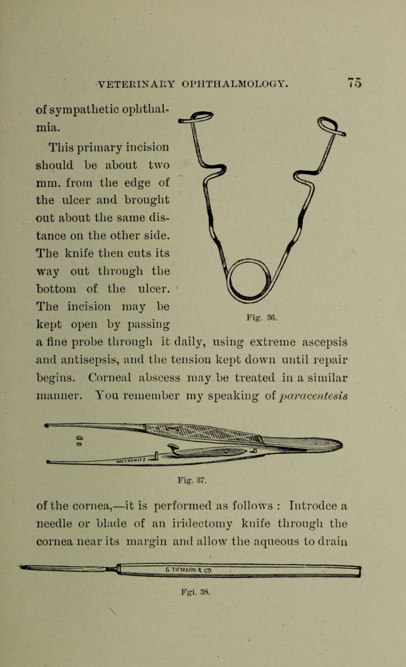 of sympathetic ophthal- mia. This primary incision should he about two mm. from the edge of the ulcer and brought out about the same dis- tance on the other side. The knife then cuts its way out through the bottom of the ulcer. The incision may he kept open by passing a fine probe through it daily, using extreme ascepsis and antisepsis, and the tension kept down until repair begins. Corneal abscess may be treated in a similar manner. You remember my speaking oi paracentesis Fig. 37. of the cornea,—it is performed as follows : Introdce a needle or blade of an iridectomy knife through the cornea near its margin and allow the aqueous to drain