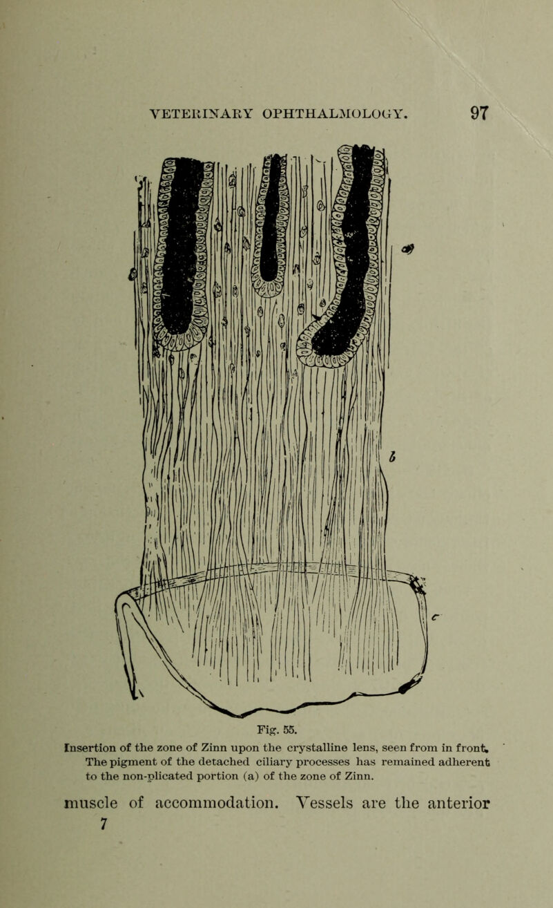 Fig. 55. Insertion of the zone of Zinn upon the crystalline lens, seen from in front. The pigment of the detached ciliary processes has remained adherent to the non-plicated portion (a) of the zone of Zinn. muscle of accommodation. Vessels are the anterior 7
