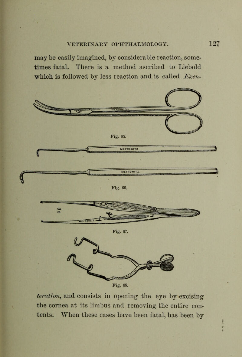may be easily imagined, by considerable reaction, some- times fatal. There is a method ascribed to Liebold which is followed by less reaction and is called Exen- MEYRQW1TZ Fig. 66. Fig. 67. teration, and consists in opening the eye by excising the cornea at its limbus and removing the entire con- tents. When these cases have been fatal, has been by