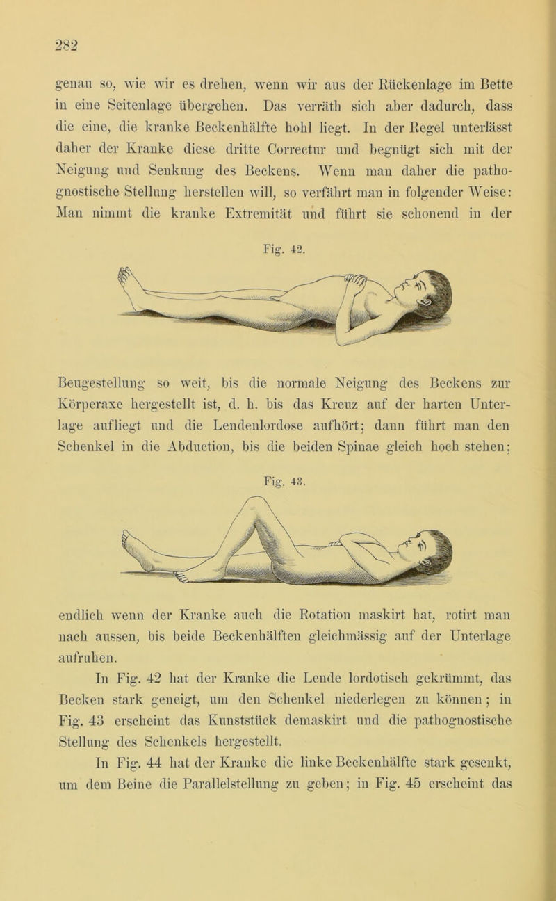 genau so, wie wir es drehen, wenn wir aus der Rückenlage im Bette in eine Seitenlage übergehen. Das verräth sich aber dadurch, dass die eine, die kranke Beckenhälfte hohl liegt. In der Regel unterlässt daher der Kranke diese dritte Correctur und begnügt sich mit der Neigung und Senkung des Beckens. Wenn man daher die patho- gnostische Stellung lierstellen will, so verfährt man in folgender Weise: Man nimmt die kranke Extremität und führt sie schonend in der Fig. 42. Beugestellung so weit, bis die normale Neigung des Beckens zur Körperaxe hergestellt ist, d. h. bis das Kreuz auf der harten Unter- lage aufliegt und die Lendenlordose aufhört; dann führt man den Schenkel in die Abduction, bis die beiden Spinae gleich hoch stehen; endlich wenn der Kranke auch die Rotation maskirt hat, rotirt man nach aussen, bis beide Beckenhälften gleichmässig auf der Unterlage aufruhen. In Fig. 42 hat der Kranke die Lende lordotisch gekrümmt, das Becken stark geneigt, um den Schenkel niederlegen zu können ; in Fig. 43 erscheint das Kunststück demaskirt und die pathognostische Stellung des Schenkels hergestellt. In Fig. 44 hat der Kranke die linke Beckenhälfte stark gesenkt, um dem Beine die Parallelstellung zu geben; in Fig. 45 erscheint das