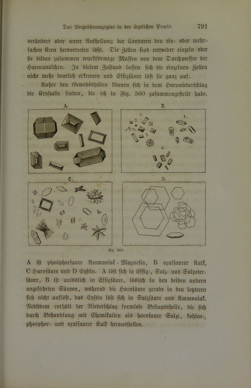 üeränbert ober unter Slufljettung bcr Souturen beu ctn^ ober mcf)r= focI)cn $ern Ijcrbortretcn täfst. ®'ie gelten finb entmeber einsein ober fic btlben sufamntett mürftförmige Sßaffen ooit bent ®urd)ineffer bcr fSarncaträldjen. 3» biefern 3uftanb taffen fid) bic einzelnen gelten nid)t meljr bcutlid) erlennen ititb (Sffigfäure töft fxe ganj auf. Singer beu ©eioebstljeileu föttnen fid) in bent £arnnteberfd)tag bic ß'rpftalte finbeit, bic id) in fyig. 360 sufanuneugeftettt l>abc. A- C. D. ■Sifl. 360. A ift pt)o3pljorfaurc Slntmoniaf * üBtagnefia, B ojealfaurer Satf, C $arnfäure unb D Gipftin. A töft fid) in ßjffig=, Safs* unb Salpeter* fäure, B ift untöStid) in (Sffigfäitrc, töölid) iit ben bcibcit aubcrn angeführten (Säuren, wätjreub bic fSarnfäure gcrabc in ben tc^tercn fid) nid)t auf töft, baS Gpftiu töft fid) in Saljfäure unb Slmntoniaf. ^ebftbcm enthält ber 9iicberfd)tag formtofe iöeftanbtf>eite, bie fid) burd) iöeffaublung mit Gitjemifatien als l)arnfaurc Satjc, foljlen*, Phosphor- unb o^alfaurer 2atf ^erau^ftetten. B.