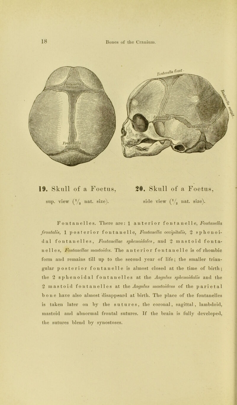 19. Skull of a Foetus, sup. view (Vg nat. size). .20. Skull of a Foetus, side view size). F 0 n t a 11 e 11 e s. There are : 1 anterior f o ii t a ii e 11 e, Fontandla frontalis, 1 posterior f o ii t a ii e 11 e, Fontandla occipitalis, 2 sphenoi- dal f 0 111 a 11 e 11 e s , Fontandlae splicnoidalcs, and 2 mastoid font a- n e 11 e s, Fontandlae mastoidcs. The anterior f o n t a n e 11 e is of rhombic form and remains till up to the second year of life; the smaller trian- gular posterior fontanelle is almost closed at the time of birth; the 2 sphenoidal fontanelles at the Angidns splicnoidalis and the 2 mastoid fontanelles at tha Angulus inastoideus of the parietal bone have also almost disappeard at birth. The i)lace of the fontanelles is taken later on by the sutures, the coronal, sagittal, lambdoid, mastoid and abnormal frontal sutures. If the brain is fully developed, tlie sutures blend by synostoses.