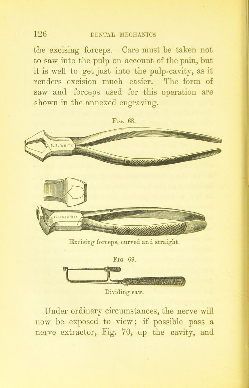 the excising forceps. Care must be taken not to saw into the pulp on account of the pain, but it is well to get just into the pulp-cavity, as it renders excision much easier. The form of saw and forceps used for this operation are shown in the annexed engraving. Fig. 68. Excising forceps, curved and straight. Fig 69. Dividing saw. Under ordinary circumstances, the nerve will now be exposed to view; if possible pass a nerve extractor, Fig. 70, up the cavity, and