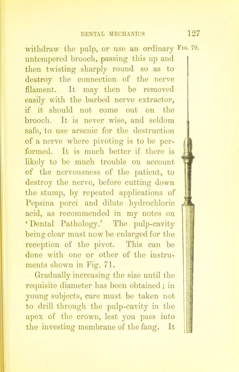 withdraw the pulp, or use an ordinary untempered brooch, passing this up and then twisting sharply round so as to destroy the connection of the nerve filament. It may then be removed easily with the barbed nerve extractor, if it should not come out on the brooch. It is never wise, and seldom safe, to use arsenic for the destruction of a nerve where pivoting is to be per- formed. It is much better if there is likely to be much trouble on account of the nervousness of the patient, to destroy the nerve, before cutting down the stump, by repeated applications of Pepsina porci and dilute hydrochloric acid, as recommended in my notes on ‘ Dental Pathology.’ The pulp-cavity being clear must now be enlarged for the reception of the pivot. This can be done with one or other of the instru- ments shown in Fig. 71. Gradually increasing the size until the requisite diameter has been obtained; in young subjects, care must be taken not to drill through the pulp-cavity in the apex of the crown, lest you pass into the investing membrane of the fang. It Fig. 70.