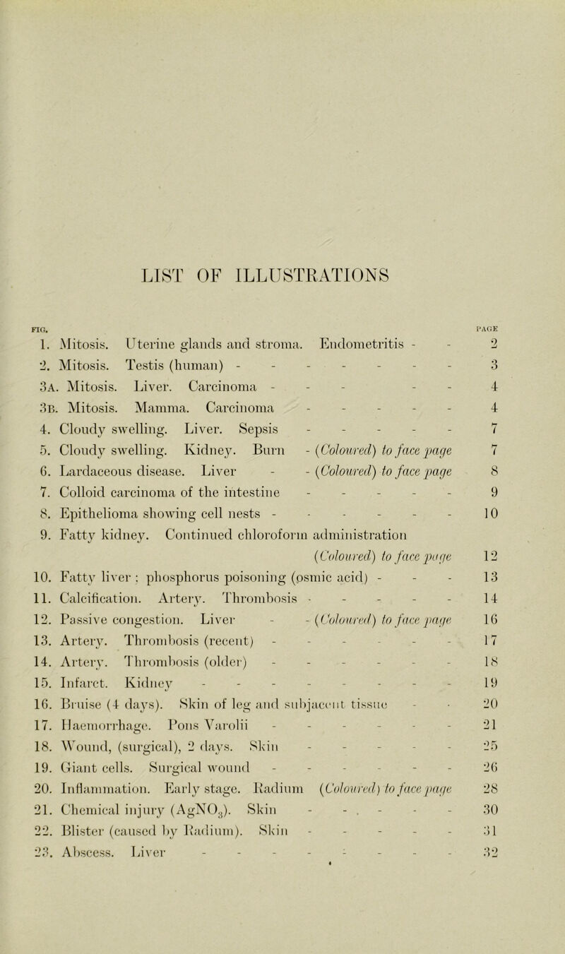 LIST OF ILLUSTRATIONS FIG. 1. Mitosis. Uterine glands and stroma. Endometritis - '2. Mitosis. Testis (bnman) ------- 3a. Mitosis. Liver. Carcinoma - - - - - 3b. Mitosis. Mamma. Carcinoma . - - - - 4. Clondy swelling. Liver. Sepsis - - - - - 5. Clondy swelling. Kidney. Burn - {Coloured) to face jmge 6. Lardaceous disease. Liver - - {Coloured) to face page 7. Colloid carcinoma of the intestine - - _ - - 8. Epithelioma showing cell nests ------ 9. Fatty kidney. Continued chloroform administration {Coloured) to face page 10. Fatty liver : phosphorus poisoning (osmic acid) - 11. Calcification. Artery. Thrombosis . - - - - 12. Passive congestion. Liver - - {Coloured) to face page 13. Artery. Thi-oml)osis (recent) ------ 14. Artery. Thrombosis (older) ------ 15. Infarct. Kidney -------- IG. Bruise (4 da}^s). Skin of leg and sul)jacciit tissue 17. llaemoi'i-hage. Pons Varolii ------ 18. Wound, (surgical), 2 flays. Sk'in - - - - - 19. Giant cells. Surgical wound ------ 20. Inflammation. Early stage. Kadium {Coloured) to face page 21. Chemical injury (AgNOg). Skin - - . - 22. Blister (caused by Padium). Slfin - . - - . 23. Altscess. Livei- . - - . i - . .