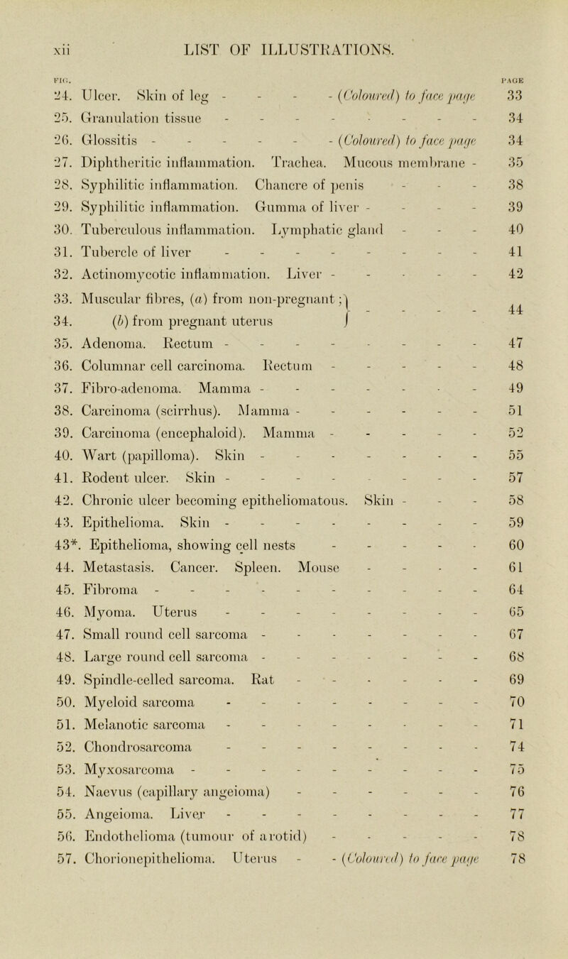l'’IC. I'AGK Ulcer. Skin of leg - - - - (CoJoumI) fo face jxu/e 33 25. CTranulation tissue . . _ - .... 34 2(). Glossitis ----- - {Coloured) to face page 34 27. Diphtheritic inflammation. Trachea. Mucous memla-ane - 35 28. Syphilitic inflammation. Chancre of penis - - - 38 29. Syphilitic inflammation. Gumma of liver - - - - 39 30. Tuberculous inflammation. Lymphatic gland - - - 40 31. Tubercle of liver -------- 41 32. Actinomycotic inflammation. Liver ----- 42 33. Muscular fibres, {a) from non-pregnant; | . - _ _ 44 34. {h) from pregnant uterus j 35. Adenoma. Rectum -------- 47 36. Columnar cell carcinoma. Rectum ----- 48 37. Fibro-adenoma. Mamma - - ----- 49 38. Carcinoma (scirrhus). Mamma - - - - - - 51 39. Carcinoma (encephaloid). Mamma ----- 52 40. Wart (papilloma). Skin ------- 55 41. Rodent ulcer. Skin - - - - - - - 57 42. Chronic ulcer becoming epitheliomatous. Skin - - - 58 43. Epithelioma. Skin -------- 59 43*. Epithelioma, showing cell nests . . . . . gQ 44. Metastasis. Cancer. Spleen. Mouse - - - - 61 45. Fibroma ---------- 64 46. Myoma. Uterus -------- 05 47. Small round cell sareoma ------- 67 48. Large round cell sarcoma ------- 68 49. Spindle-celled sarcoma. Rat - - - - - - 69 50. Myeloid sarcoma - - - - - - - - 70 51. Melanotic sarcoma - - - - - - - - 71 52. Chondrosarcoma - - - - - - - - 74 53. Myxosarcoma - - - - - - - - - 75 54. Naevus (capillary angeioma) - - - - - - 76 55. Angeioma. Live.r - - - - - - - - 77 56. Endothelioma (tumonr of arotid) - - - - - 78 57. Chorionepithelioma. llterus - - (Coloured) to face page 78