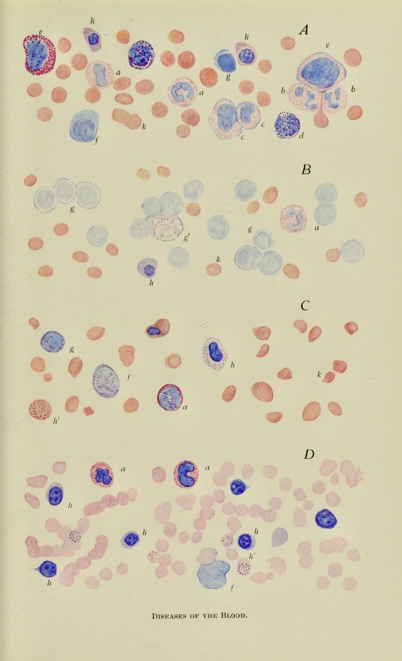 Diseases of the Blood