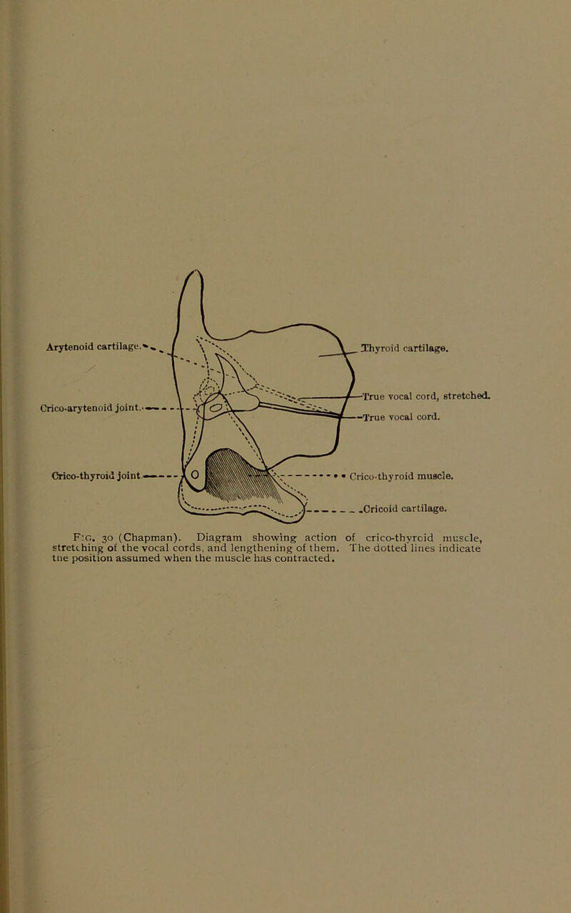 Crico-arytenoid joint.'— Crico-thyroid joint Thyroid cartilage. •True vocal cord, stretched. —True vocal cord. Crico-thyroid muscle. _ .Cricoid cartilage. F:g. 30 (Chapman). Diagram showing action of crico-thyroid muscle, stretching of the vocal cords, and lengthening of them. The dotted lines indicate tne position assumed when the muscle has contracted.