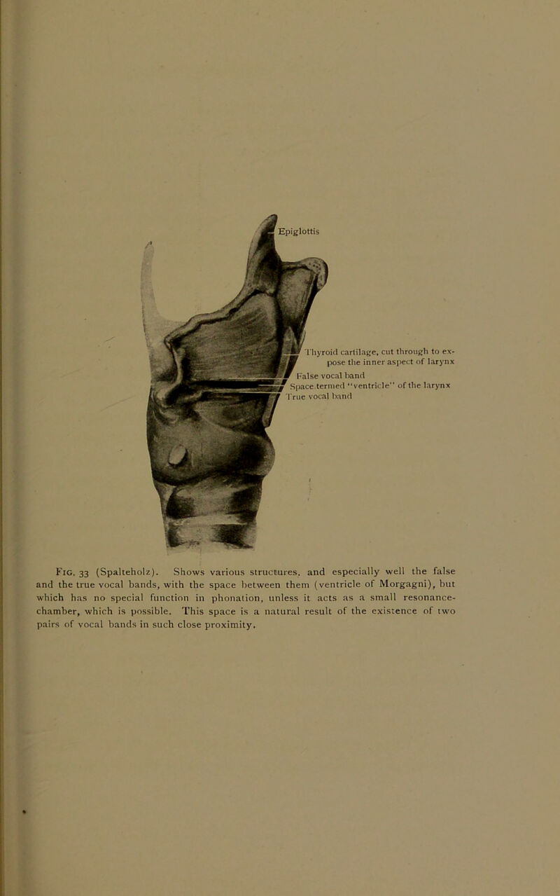 Thyroid cartilage, cut through to ex- pose the inner aspect of larynx False vocal band Space.termed “ventricle” of the larynx True vocal band Fig. 33 (Spalteholz). Shows various structures, and especially well the false and the true vocal bands, with the space between them (ventricle of Morgagni), but which has no special function in phonation, unless it acts as a small resonance- chamber, which is possible. This space is a natural result of the existence of two pairs of vocal bands in such close proximity.