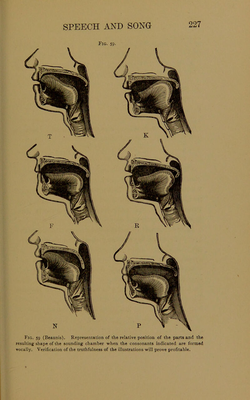 Pig. 59- Fig. 59 (Beaunis). Representation of the relative position of the parts and the resulting shape of the sounding chamber when the consonants indicated are formed vocally. Verification of the truthfulness of the illustrations will prove profitable.