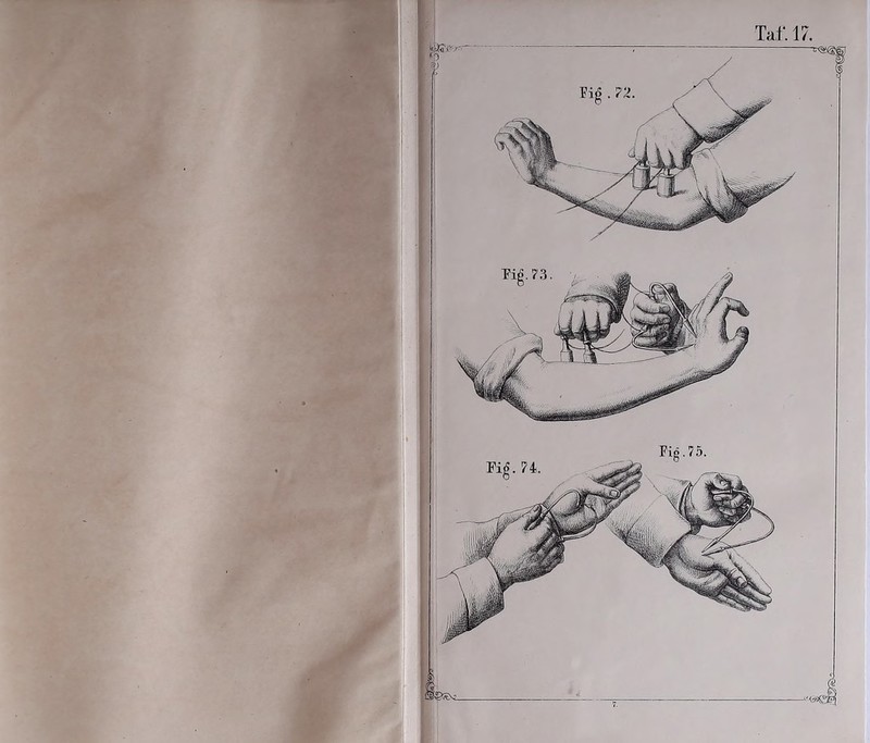 Tat'. 17.