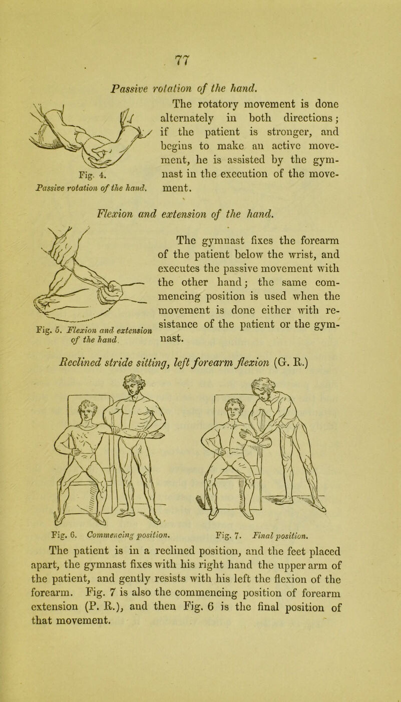 Fig. 4. Passive rotation of the hand, Passive rotation of the hand. The rotatory movement is done alternately in both directions; if the patient is stronger, and begins to make an active move- ment, he is assisted by the gym- nast in the execution of the move- ment. Flexion and extension of the hand. Fig. o. Flexion and'■ extension of the hand. The gymnast fixes the forearm of the patient below the wrist, and executes the passive movement with the other hand; the same com- mencing position is used when the movement is done either with re- sistance of the patient or the gym- nast. Reclined stride sitting, left forearm flexion (G. R.) Fig. 6. Commencing position. Fig. 7* Final position. The patient is in a reclined position, and the feet placed apart, the gymnast fixes with his right hand the upper arm of the patient, and gently resists with his left the flexion of the forearm. Fig. 7 is also the commencing position of forearm extension (P. R.), and then Fig. 6 is the final position of that movement.