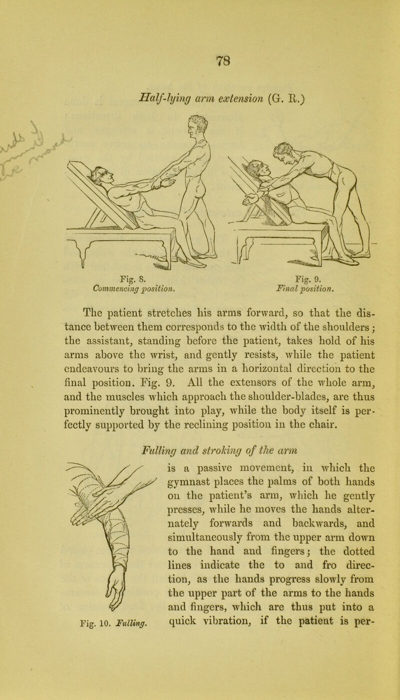 Half-lying arm extension (G. U.) Fig. 8. Commencing position. Fig. 9. Final position. The patient stretches liis arms forward, so that the dis- tance between them corresponds to the width of the shoulders; the assistant, standing before the patient, takes hold of his arms above the wrist, and gently resists, while the patient endeavours to bring the arms in a horizontal direction to the final position. Fig. 9. All the extensors of the whole arm, and the muscles which approach the shoulder-blades, are thus prominently brought into play, while the body itself is per- fectly supported by the reclining position in the chair. Fulling and stroking of the arm Fig. 10. Fulling. is a passive movement, in which the gymnast places the palms of both hands on the patient’s arm, which he gently presses, wdiile he moves the hands alter- nately forwards and backwards, and simultaneously from the upper arm down to the hand and fingers; the dotted lines indicate the to and fro direc- tion, as the hands progress slowly from the upper part of the arms to the hands and fingers, which are thus put into a quick vibration, if the patient is per-