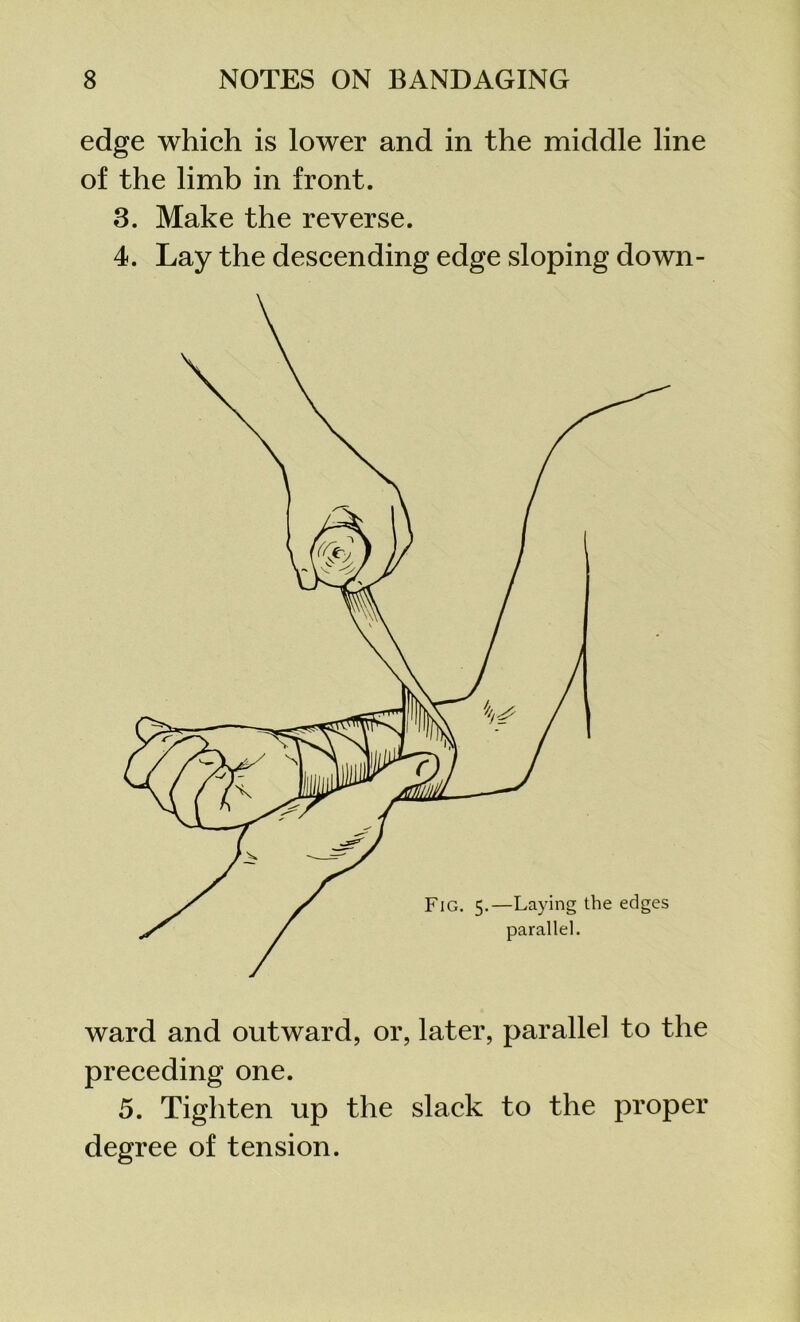 edge which is lower and in the middle line of the limb in front. 3. Make the reverse. 4. Lay the descending edge sloping down- ward and outward, or, later, parallel to the preceding one. 5. Tighten up the slack to the proper degree of tension.