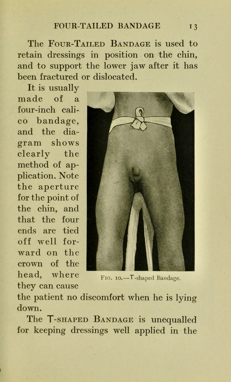 The Four-Tailed Bandage is used to retain dressings in position on the chin, and to support the lower jaw after it has been fractured or dislocated. It is usually made of a four-inch cali- co bandage, and the dia- gram shows clearly the method of ap- plication. Note the aperture for the point of the chin, and that the four ends are tied off well for- ward on the crown of the head, where they can cause the patient no discomfort when he is lying down. The T-siiaped Bandage is unequalled for keeping dressings well applied in the Fig. 10.—T-shaped Bandage.