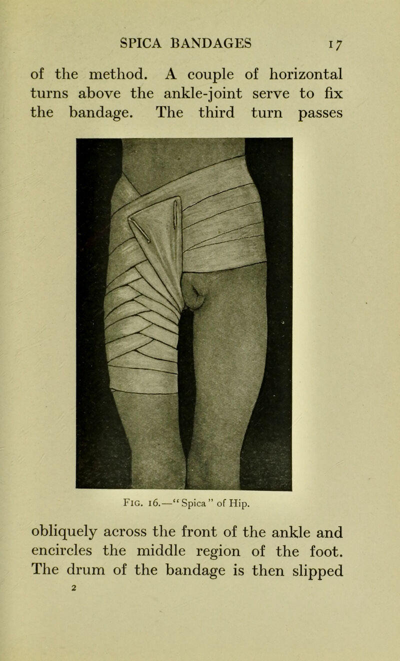 SPICA BANDAGES obliquely across the front of the ankle and encircles the middle region of the foot. The drum of the bandage is then slipped 17 of the method. A couple of horizontal turns above the ankle-joint serve to fix the bandage. The third turn passes Fig. 16.—“ Spica ” of Hip.