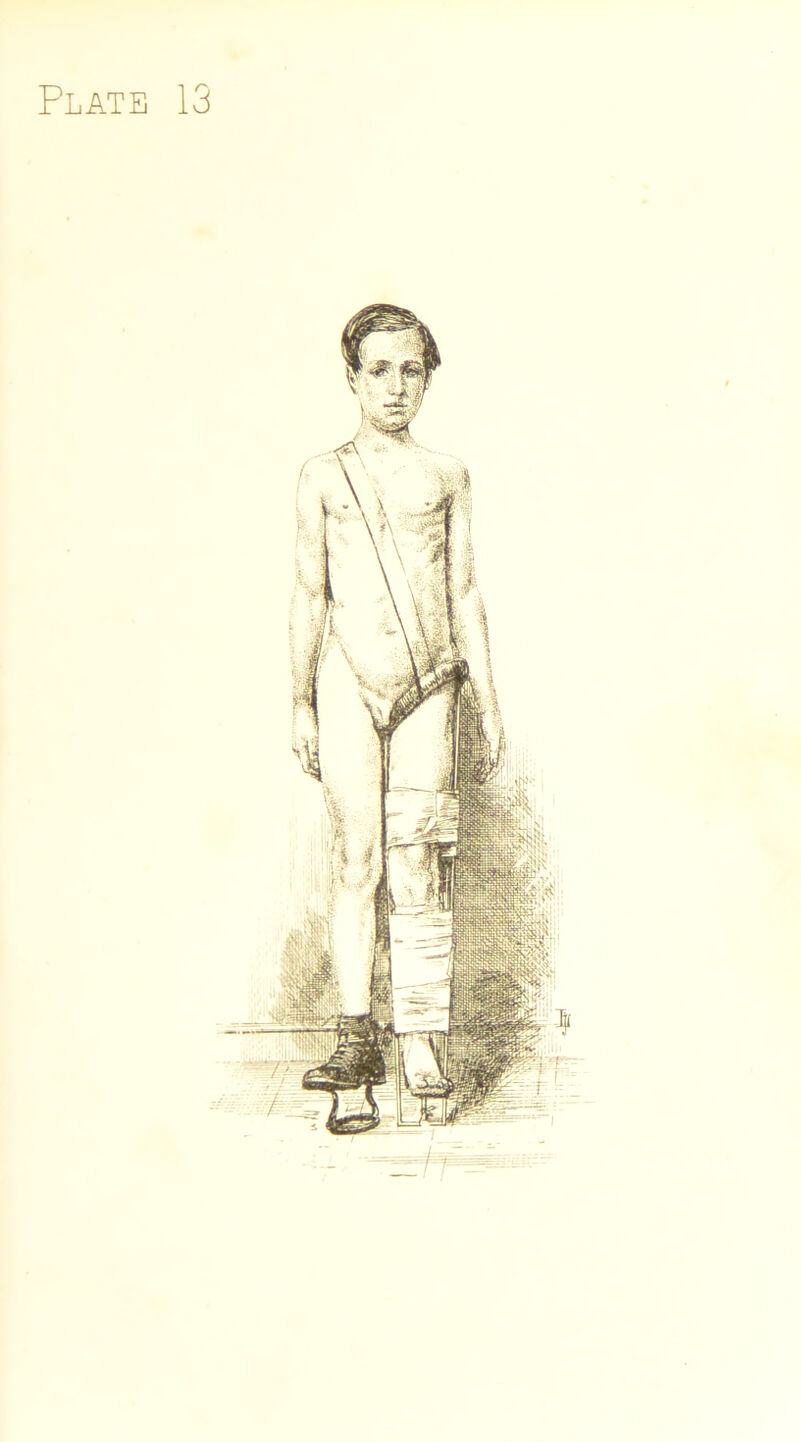 Plate 13