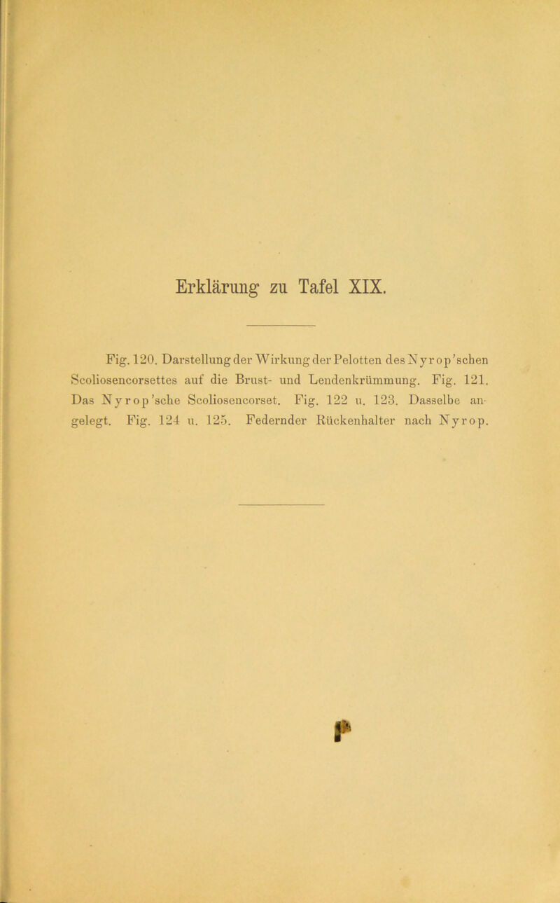 Fig. 120. Darstellung der Wirkung der Pelotten desNyrop'schen Scoliosencorsettes auf die Brust- und Lendenkrümmung. Fig. 121. Das Nyrop’sche Scoliosencorset. Fig. 122 u. 123. Dasselbe an- gelegt. Fig. 124 u. 125. Federnder Rückenhalter nach Nyrop.