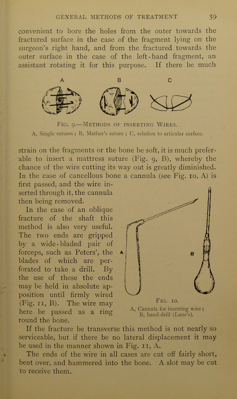 convenient to bore the holes from the outer towards the fractured surface in the case of the fragment lying on the surgeon’s right hand, and from the fractured towards the outer surface in the case of the left-hand fragment, an assistant rotating it for this purpose. If there be much Fig. 9.—Methods of inserting Wires. A, Single sutures ; B, Mather’s suture ; C, relation to articular surface. strain on the fragments or the bone be soft, it is much prefer- able to insert a mattress suture (Fig. g, B), whereby the chance of the wire cutting its way out is greatly diminished. In the case of cancellous bone a cannula (see Fig. 10, A) is first passed, and the wire in- serted through it, the cannula then being removed. In the case of an oblique fracture of the shaft this method is also very useful. The two ends are gripped by a wide - bladed pair of forceps, such as Peters’, the blades of which are per- forated to take a drill. By the use of these the ends may be held in absolute ap- position until firmly wired (Fig. II, B). The wire may here be passed as a ring round the bone. If the fracture be transverse this method is not nearly so serviceable, but if there be no lateral displacement it may be used in the manner shown in Fig. ii, A. The ends of the wire in all cases are cut off fairly short, bent over, and hammered into the bone. A slot may be cut to receive them. A, Cannula for inserting wire ; B, hand-drill (Lane’s).