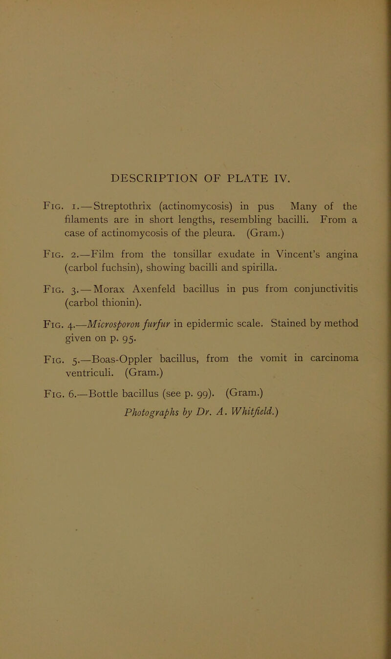 Fig. I. — Streptothrix (actinomycosis) in pus Many of the filaments are in short lengths, resembling bacilli. From a case of actinomycosis of the pleura. (Gram.) Fig. 2.—Film from the tonsillar exudate in Vincent’s angina (carbol fuchsin), showing bacilli and spirilla. Fig. 3. — Morax Axenfeld bacillus in pus from conjunctivitis (carbol thionin). Fig. 4.—Microsporon furfur in epidermic scale. Stained by method given on p. 95. Fig. 5.—Boas-Oppler bacillus, from the vomit in carcinoma ventriculi. (Gram.) Fig. 6.—Bottle bacillus (see p. 99). (Gram.) Photographs by Dr. A. Whitfield.)