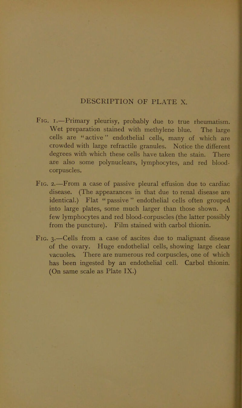 Fig. I.—Primary pleurisy, probably due to true rheumatism. Wet preparation stained with methylene blue. The large cells are “active” endothelial cells, many of which are crowded with large refractile granules. Notice the different degrees with which these ceils have taken the stain. There are also some polynuclears, lymphocytes, and red blood- corpuscles. Fig. 2.—From a case of passive pleural effusion due to cardiac disease. (The appearances in that due to renal disease are identical.) Flat “ passive ” endothelial cells often grouped into large plates, some much larger than those shown, A few lymphocytes and red blood-corpuscles (the latter possibly from the puncture). Film stained with carbol thionin. Fig. 3.—Cells from a case of ascites due to malignant disease of the ovary. Huge endothelial cells, showing large clear vacuoles. There are numerous red corpuscles, one of which has been ingested by an endothelial cell. Carbol thionin.