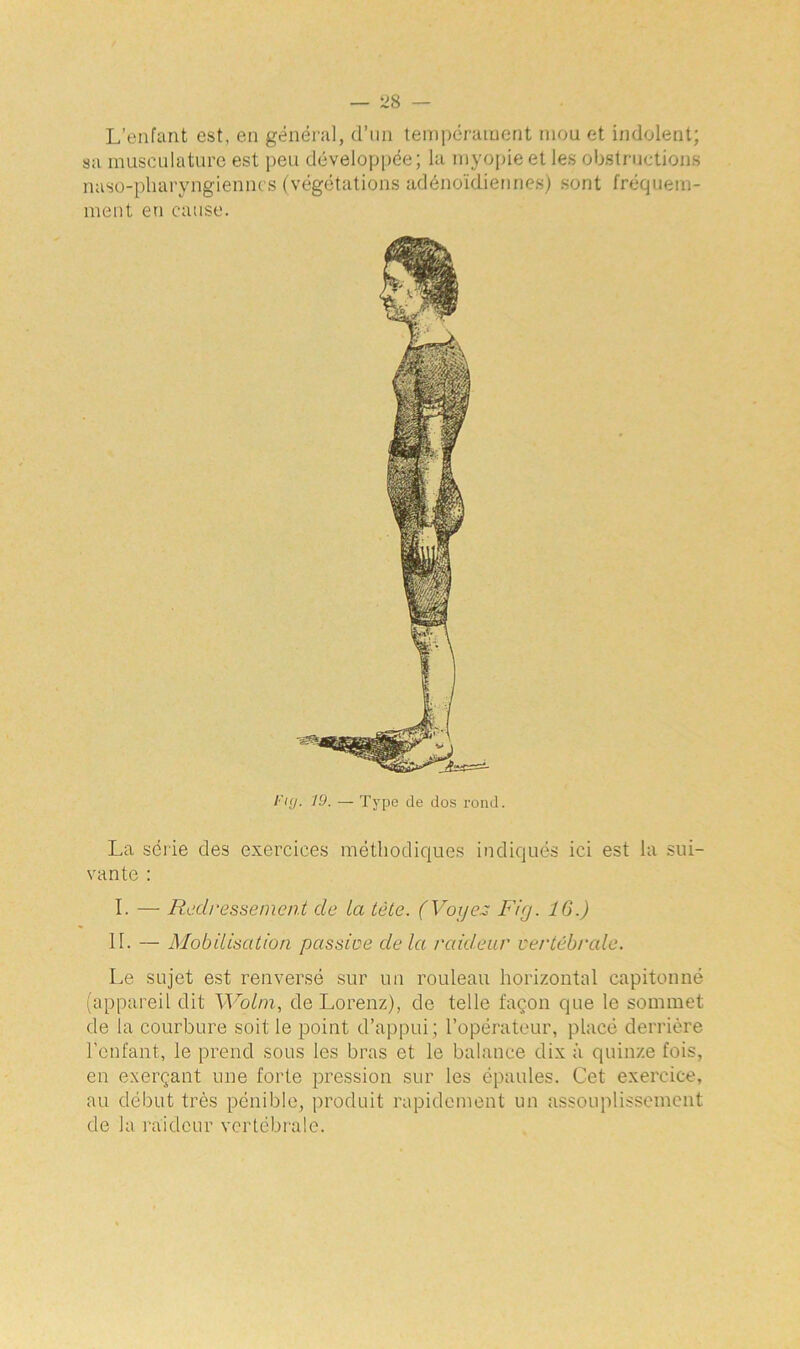 L’enfant est, en général, d’un tempérament mou et indolent; sa musculature est peu développée; la myopie et les obstructions naso-pharyngienncs (végétations adénoïdiennes) sont fréquem- ment eu cause. I'kj. 19. — Type de dos rond. La série des exercices méthodiques indiqués ici est la sui- vante : I. — Redressement de ta tête. (Voyez Fig. 16.) IL — Mobilisation passive delà raideur vertébrale. Le sujet est renversé sur un rouleau horizontal capitonné (appareil dit Wolm, de Lorenz), de telle façon que le sommet de la courbure soit le point d’appui ; l’opérateur, placé derrière l’enfant, le prend sous les bras et le balance dix à quinze fois, en exerçant une forte pression sur les épaules. Cet exercice, au début très pénible, produit rapidement un assouplissement de la raideur vertébrale.