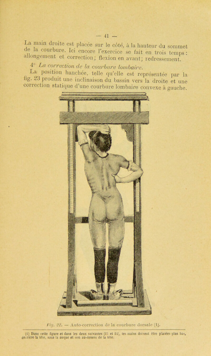 La main droite est placée sur le côté, à la hauteur du sommet de la courbure. Ici encore l’exercice se fait en trois temps: allongement et correction; flexion en avant; redressement. 4 La correction de la courbure lombaire. La. position hanchée, telle qu’elle est représentée par la fig. 2J Produit une inclinaison du bassin vers la droite et une correction statique d’une courbure lombaire convexe à gauche. Fig. 22. — Auto-correction île la courbure dorsale (lj. (1) Dans relie figure et dans les deux suivantes (23 et 21), les mains doivent tire placées plus bas, dei nérc la tète, sous la nuque et non au-dessus de la tète.