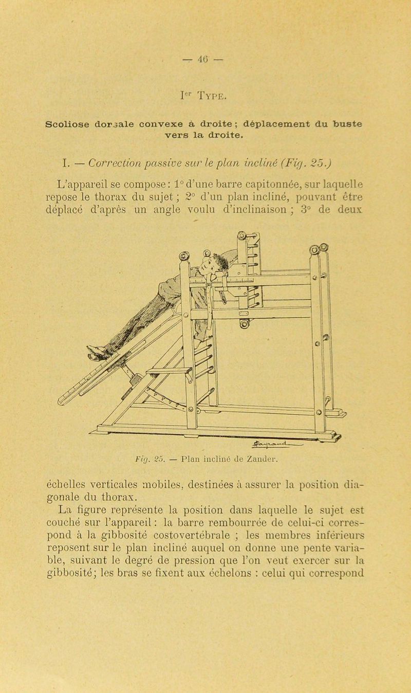 — 40 — Ier Type. Scoliose dorsale convexe à droite ; déplacement du buste vers la droite. I. — Correction passive sur le plan incliné (Fifj. 25.) L’appareil se compose : 1° d’une barre capitonnée, sur laquelle repose le thorax du sujet ; 2° d’un plan incliné, pouvant être déplacé d’après un angle voulu d’inclinaison ; 3° de deux échelles verticales mobiles, destinées à assurer la position dia- gonale du thorax. La ligure représente la position dans laquelle le sujet est couché sur l’appareil : la barre rembourrée de celui-ci corres- pond à la gibbosité costovertébrale ; les membres inférieurs reposent sur le plan incliné auquel on donne une pente varia- ble, suivant le degré de pression que l’on veut exercer sur la gibbosité; les bras se fixent aux échelons : celui qui correspond