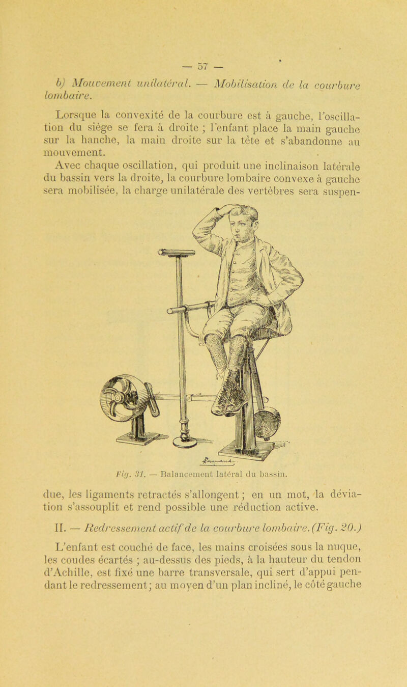 b) Mouvement unilatéral. — Mobilisation de la courbure lombaire. Lorsque la convexité de la courbure est à gauche, l’oscilla- tion du siège se fera à droite ; l'enfant place la main gauche sur la hanche, la main droite sur la tète et s’abandonne au mouvement. Avec chaque oscillation, qui produit une inclinaison latérale du bassin vers la droite, la courbure lombaire convexe à gauche sera mobilisée, la charge unilatérale des vertèbres sera suspen- Fig. 31. — Balancement latéral du bassin. due, les ligaments rétractés s’allongent ; en un mot, la dévia- tion s’assouplit et rend possible une réduction active. II. — Redressement actif de la courbure lombaire. (Fig. 20.) L’enfant est couché de face, les mains croisées sous la nuque, les coudes écartés ; au-dessus des pieds, à la hauteur du tendon d’Achille, est fixé une barre transversale, qui sert d’appui pen- dant le redressement; au moyen d’un plan incliné, le côté gauche