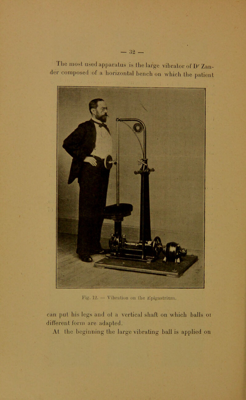 Tlie mosl used appuralus is the large vibrator of 1)'‘ Zan- der composed of a horizontal bench on which the patient Fig. 12. — Vibratiuu on Ihe Eiiigastrium. can put his legs and ol a vertical shaft on which balls oi dilferent form are adapted. At the beginning the large vibrating ball is applied on