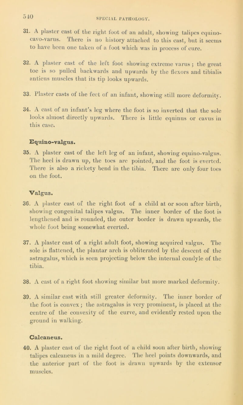 SPECIAL PATIIOLOGV. 31. A plaster cast oi' the cavo-varus. There is right toot oi’ an adult, showing talipes equino- no history attached to this cast, but it seems to have been one taken of a foot which was in process of cure. 32. A plaster cast ot the left loot showing extreme varus ; the great toe is so pulled backwards and upwards by tlie liexors and tibialis anticus muscles that its tip looks upwards. 33. Plaster casts ol the feet ol an infant, showing still more deformity. 34. A cast of an infant’s leg where the foot is so inverted that the sole looks almost directly upwards. There is little equinus or cavus in this case. Equino-valgus. 35. A plaster cast of the left leg of an infant, showing equino-valgus. The heel is drawn up, the toes are pointed, and the foot is everted. There is also a rickety bend in the tibia. There are only four toes on the foot. Valgus. 36. A plaster cast of the right foot of a child at or soon after birth, showing congenital talipes valgus. The inner border of the foot is lengthened and is rounded, the outer border is drawn upwards, the whole foot being somewhat everted. 37. A plaster cast of a right adult foot, showing acquired valgus. The sole is flattened, the plantar arch is obliterated by the descent of the astragalus, which is seen projecting below the internal condyle of the tibia. 38. A cast of a right foot showing similar but more marked deformity. 39. A similar cast with still greater deformity. The inner border of the foot is convex; the astragalus is very prominent, is placed at the centre of the convexity of the curve, and evidently rested upon the ground in walking. Calcaneus. 40. A plaster cast of the right foot of a child soon after birth, showing- talipes calcaneus in a mild degree. The heel points downwards, and the anterior part of the foot is drawn upwards by the extensor muscles.